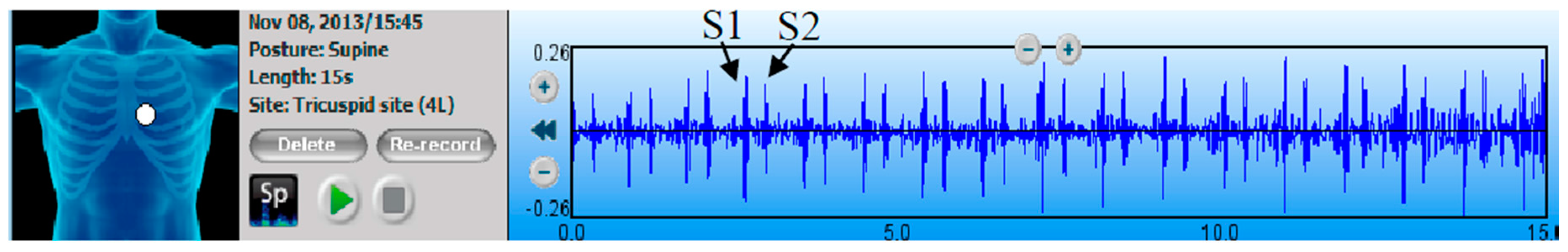 Entropy 18 00281 g001 1024