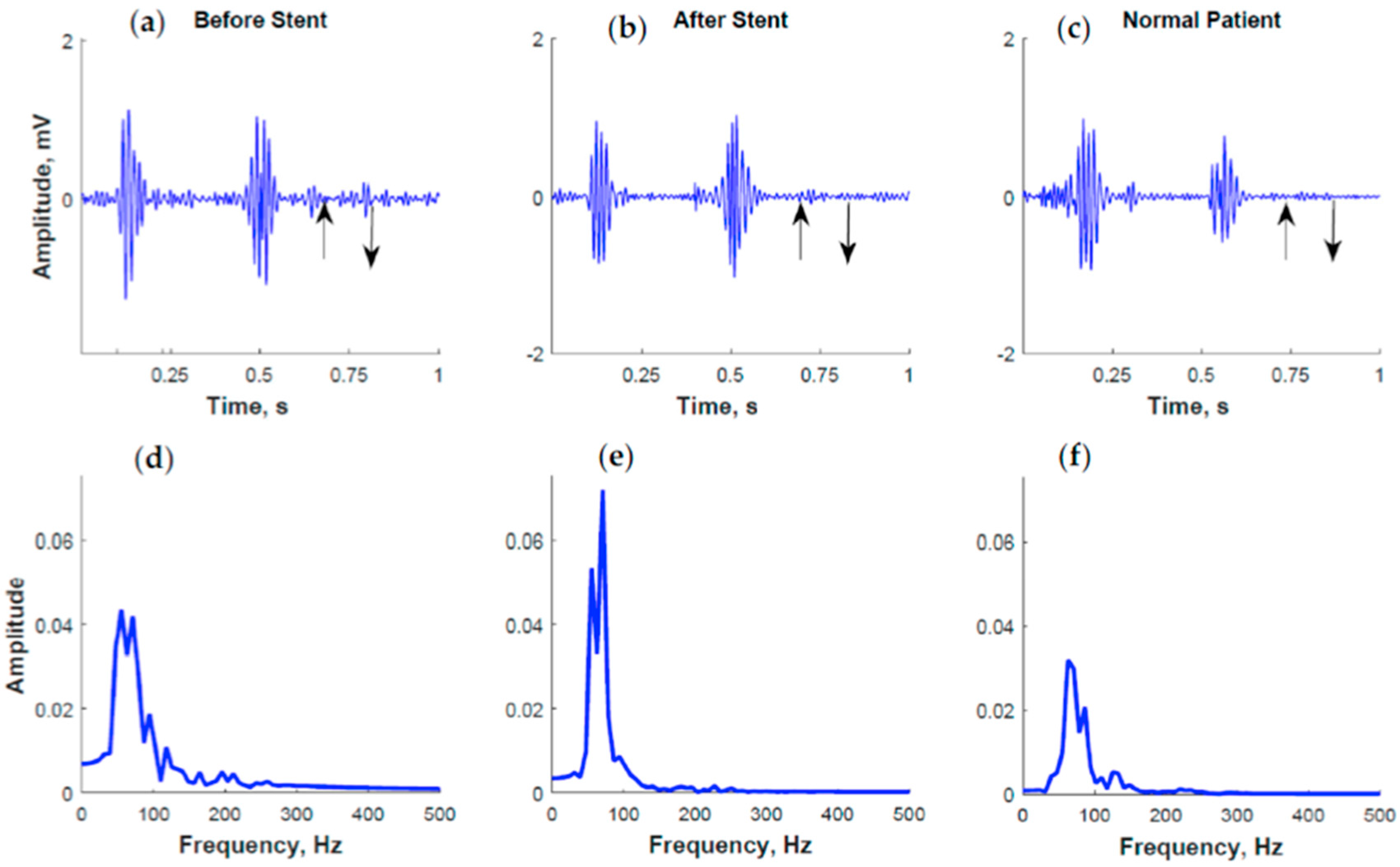 Entropy 18 00281 g003 1024
