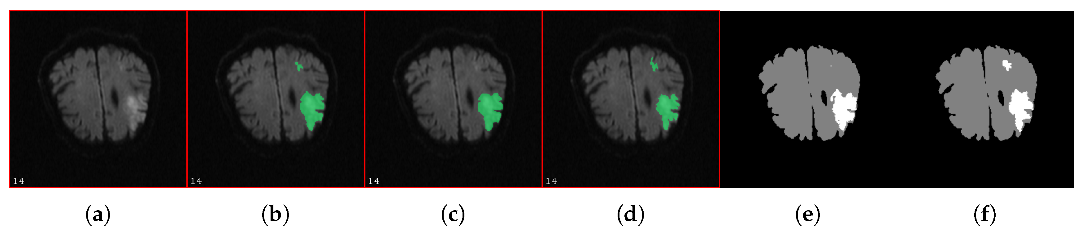 Entropy 19 00187 g005