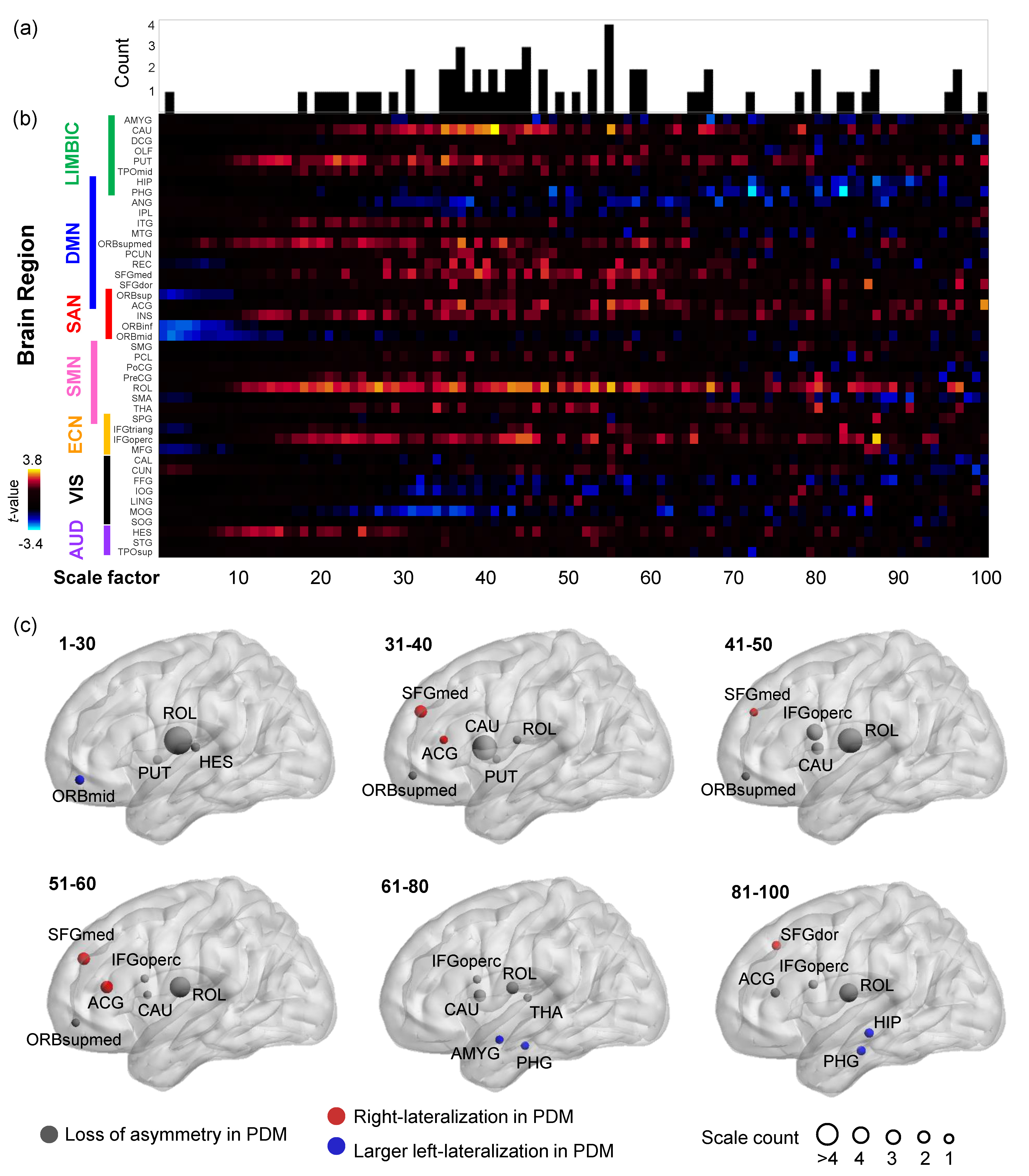 Entropy Free Full Text Altered Brain Complexity In Women With Primary Dysmenorrhea A Resting State Magneto Encephalography Study Using Multiscale Entropy Analysis Html