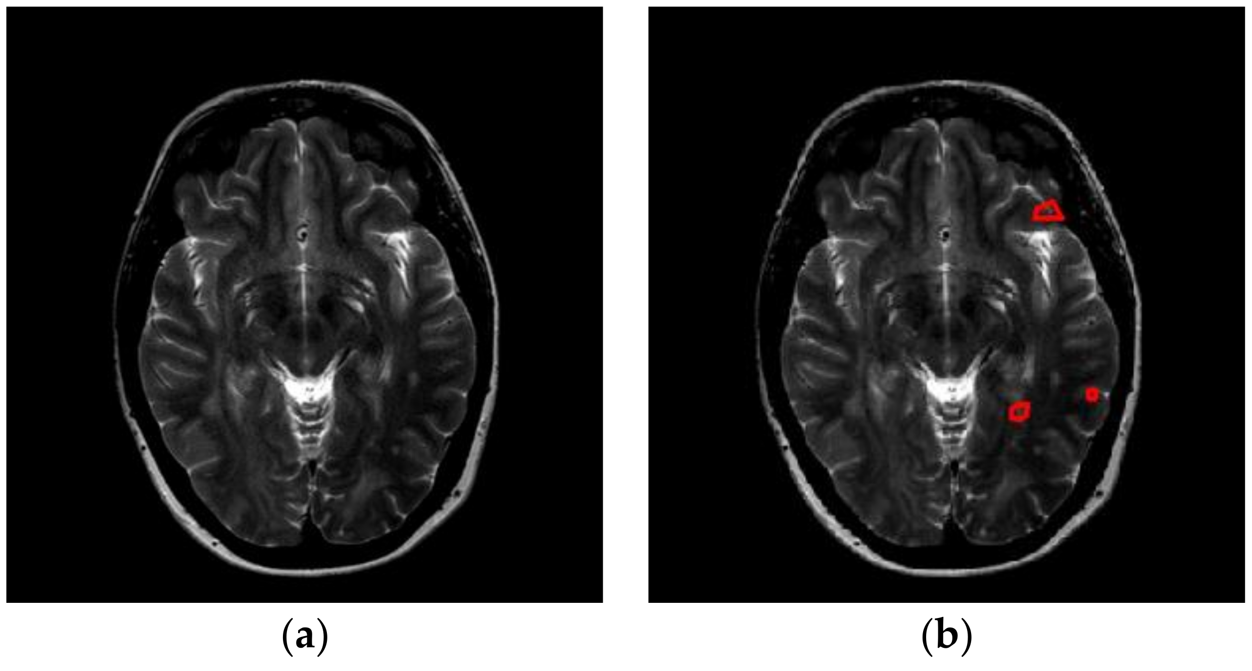 Entropy 20 00254 g001