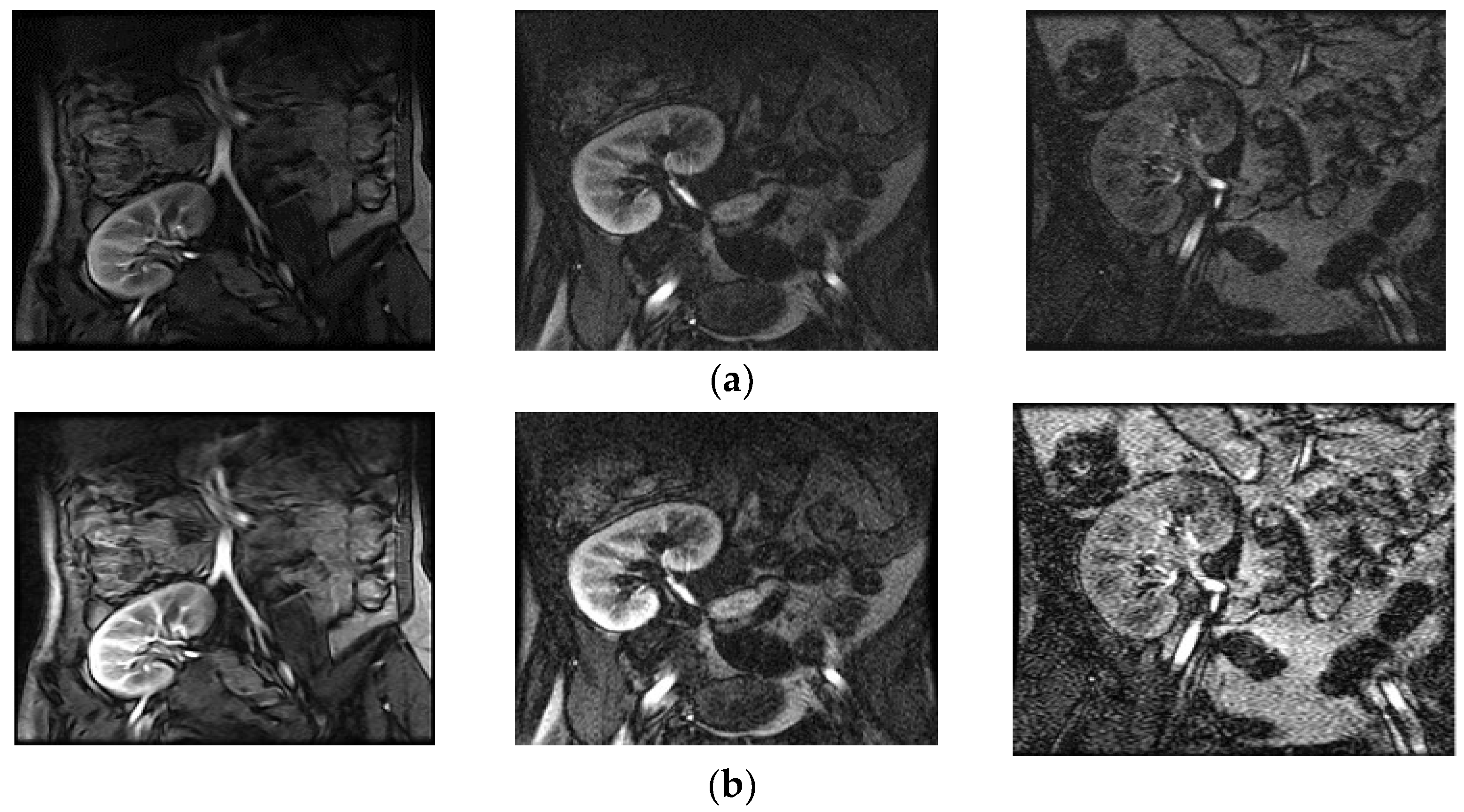 Entropy 20 00344 g005a 550