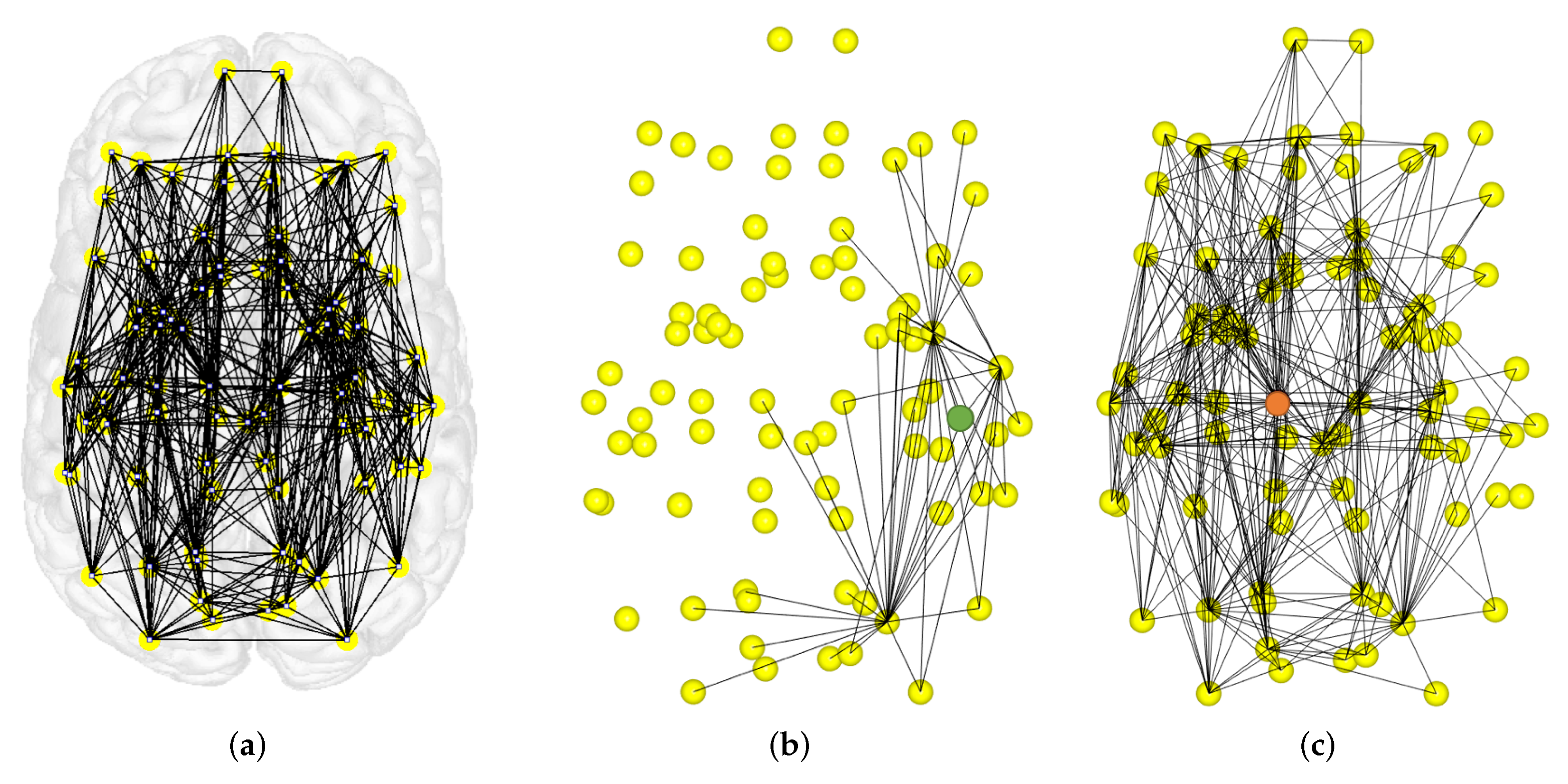 Entropy 20 00491 g011 Entropy 20 00491 g011