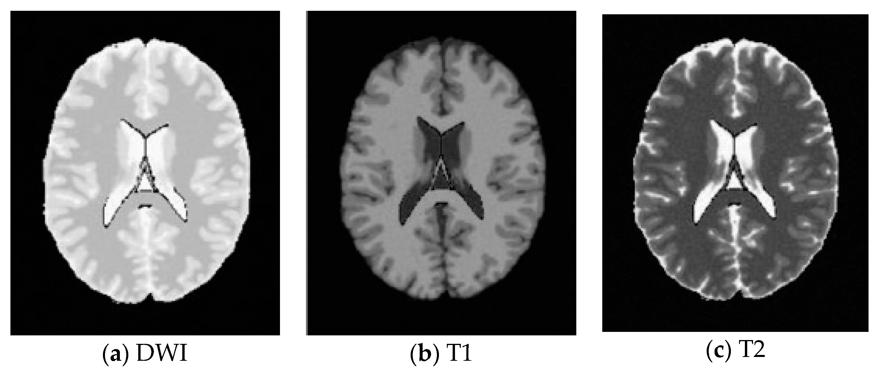 Entropy 20 00964 g009