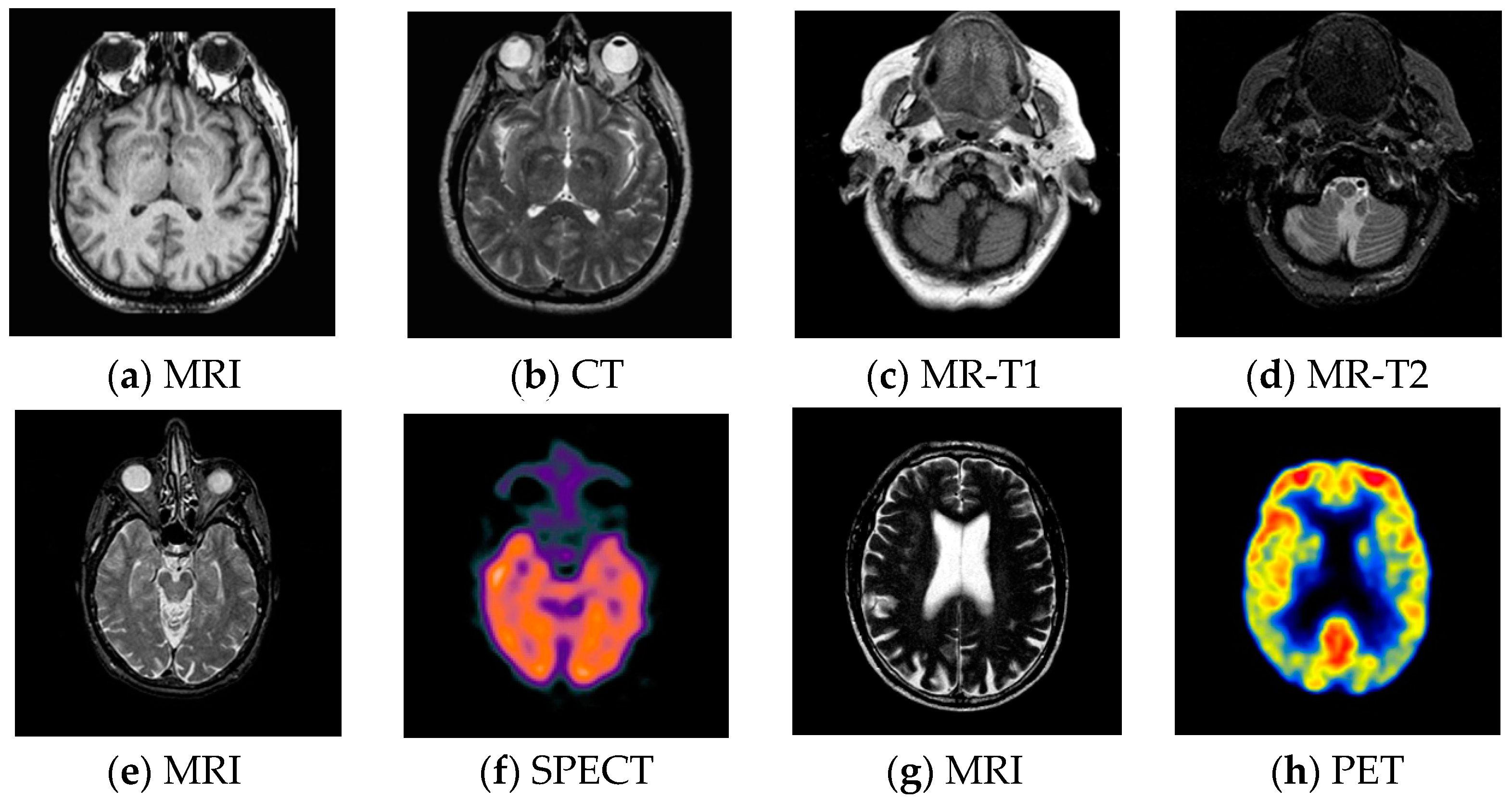 Entropy 21 00267 g006 Entropy 21 00267 g006