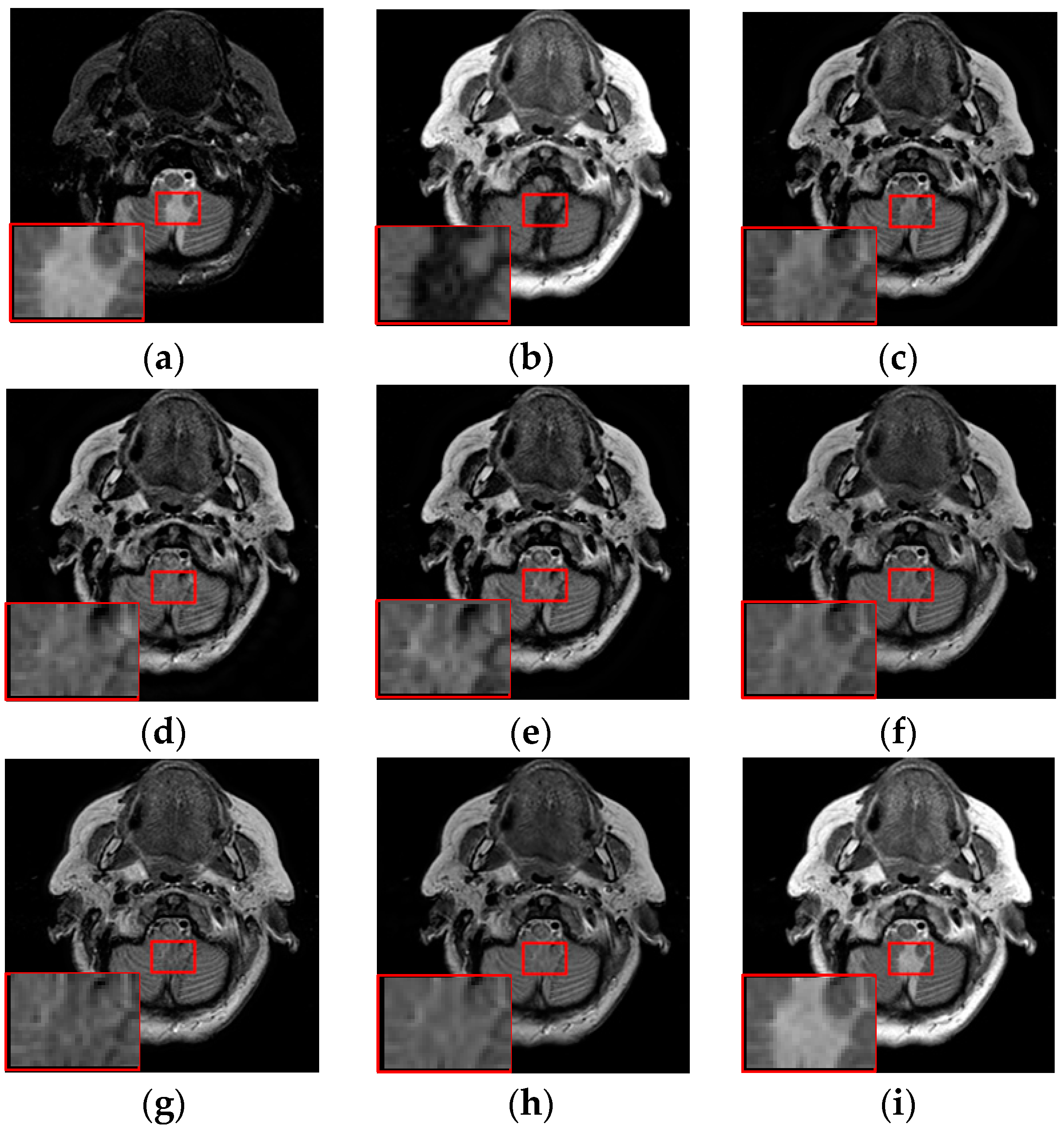 Entropy 21 00267 g008 Entropy 21 00267 g008