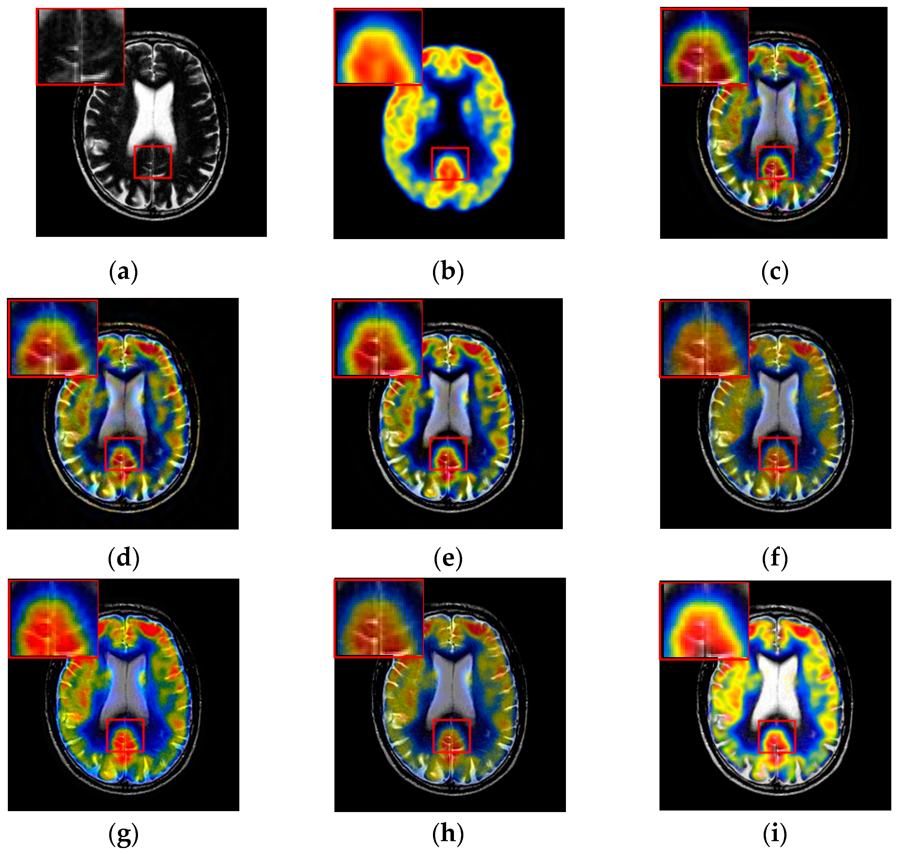 Entropy 21 00267 g010 Entropy 21 00267 g010