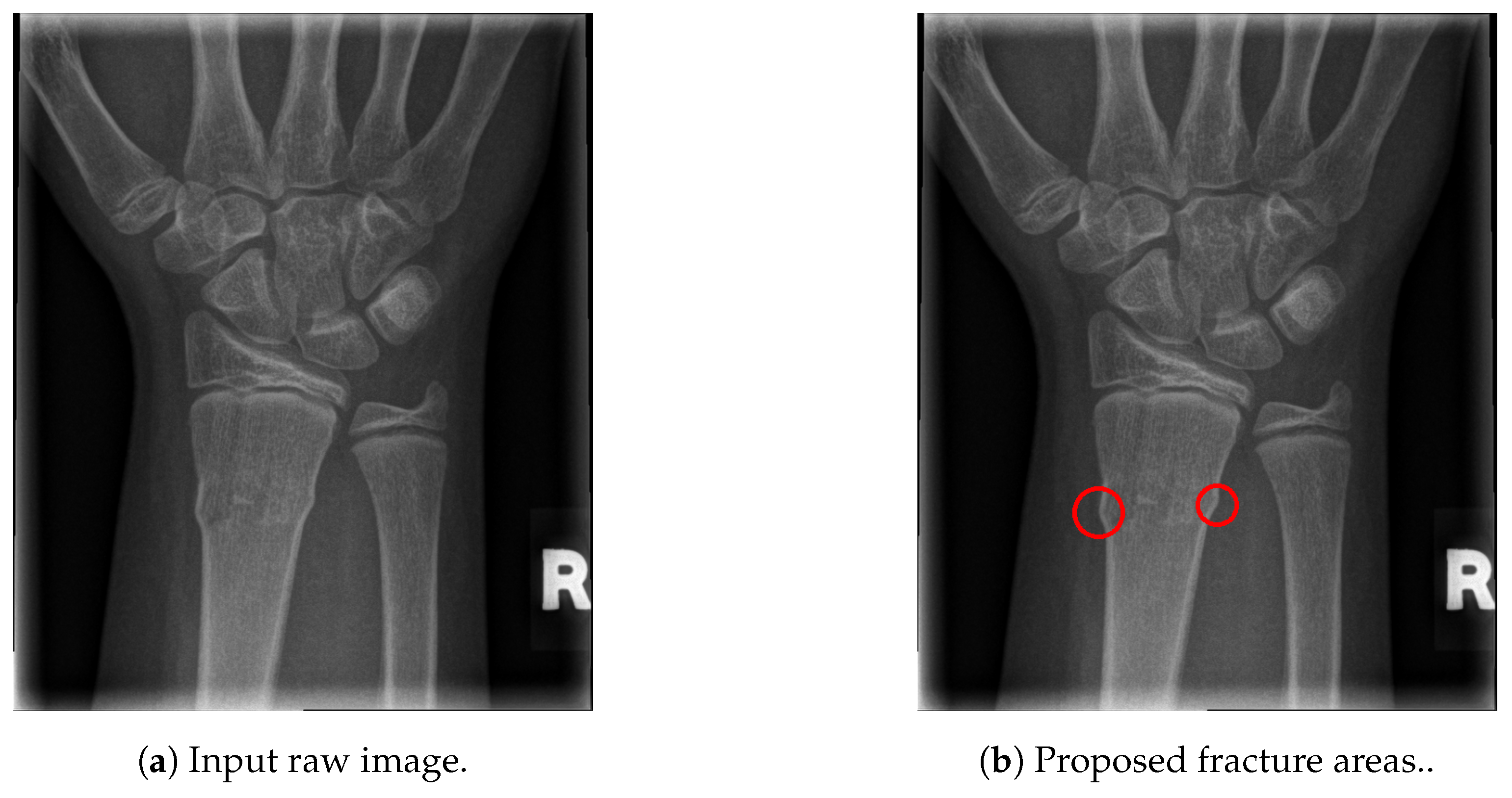 Entropy 21 00338 g016 Entropy 21 00338 g016