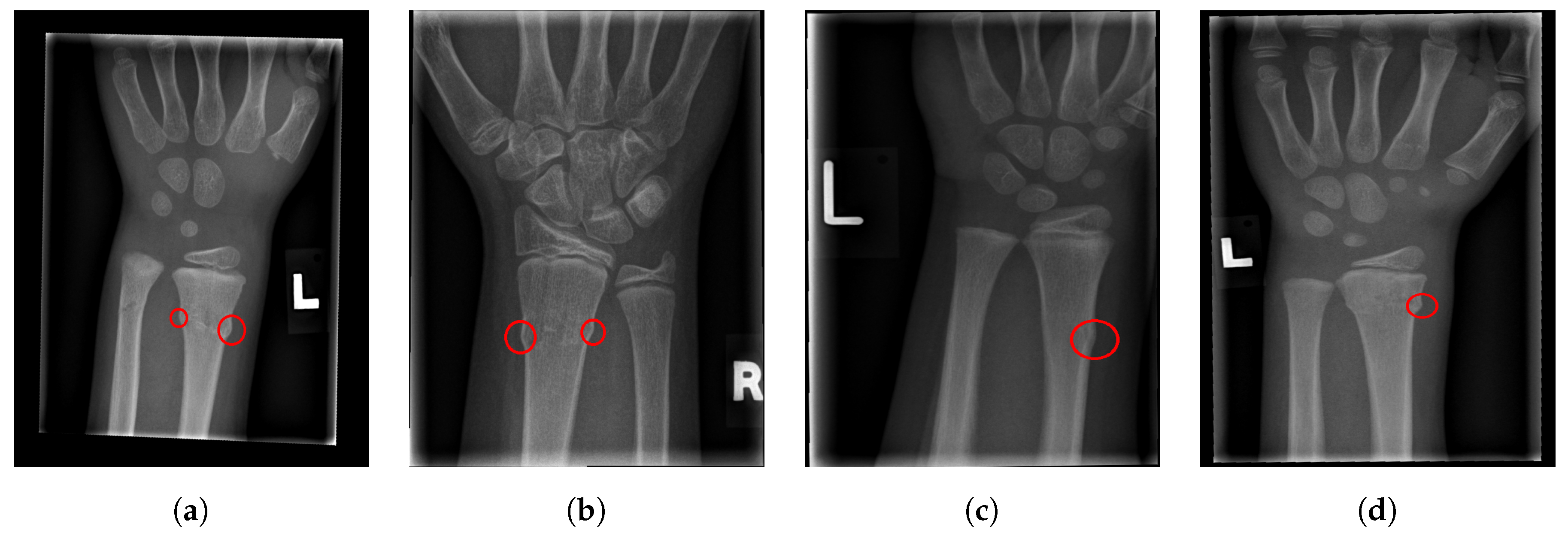 Entropy 21 00338 g017 Entropy 21 00338 g017