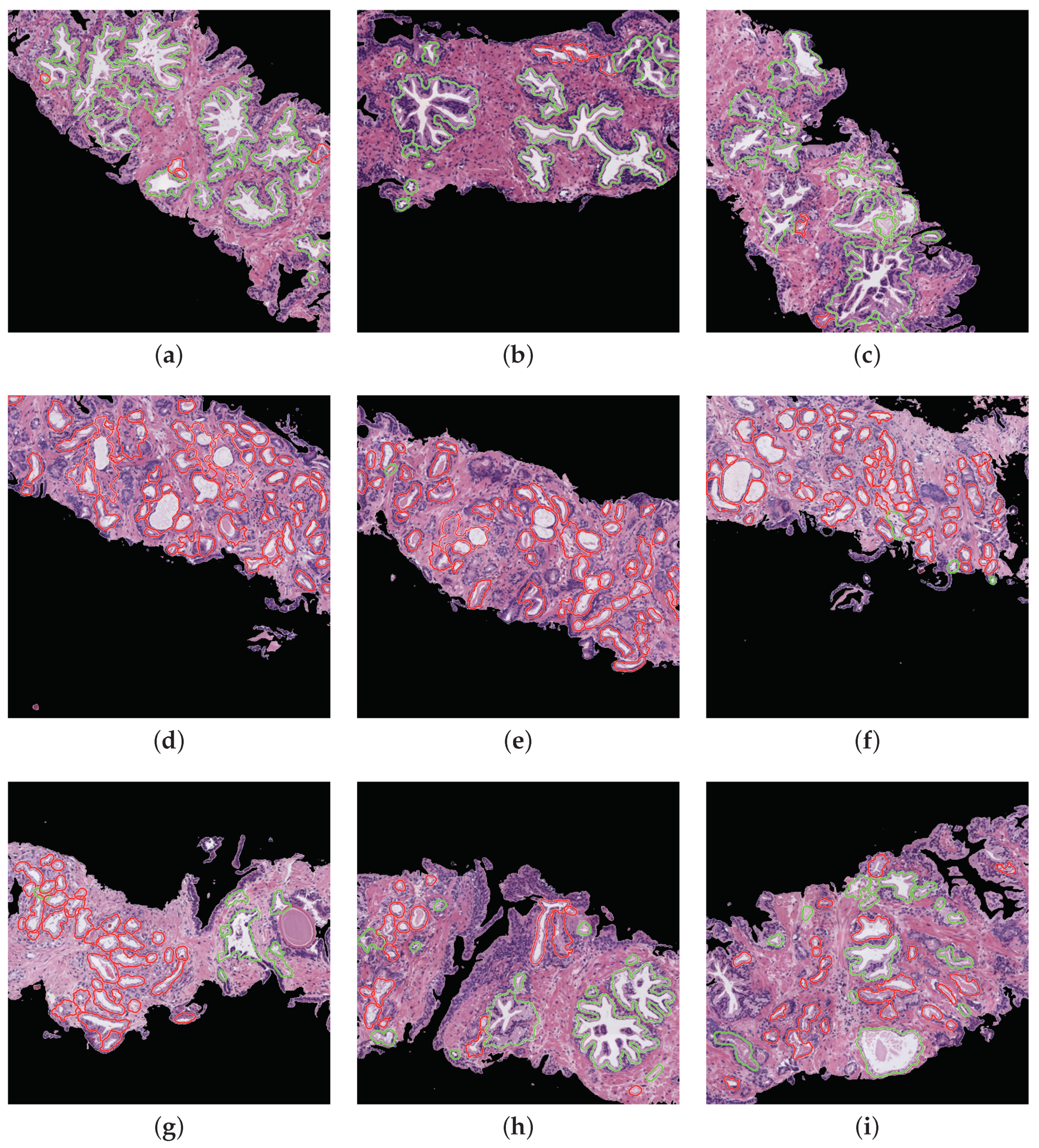 Entropy 21 00356 g016 Entropy 21 00356 g016