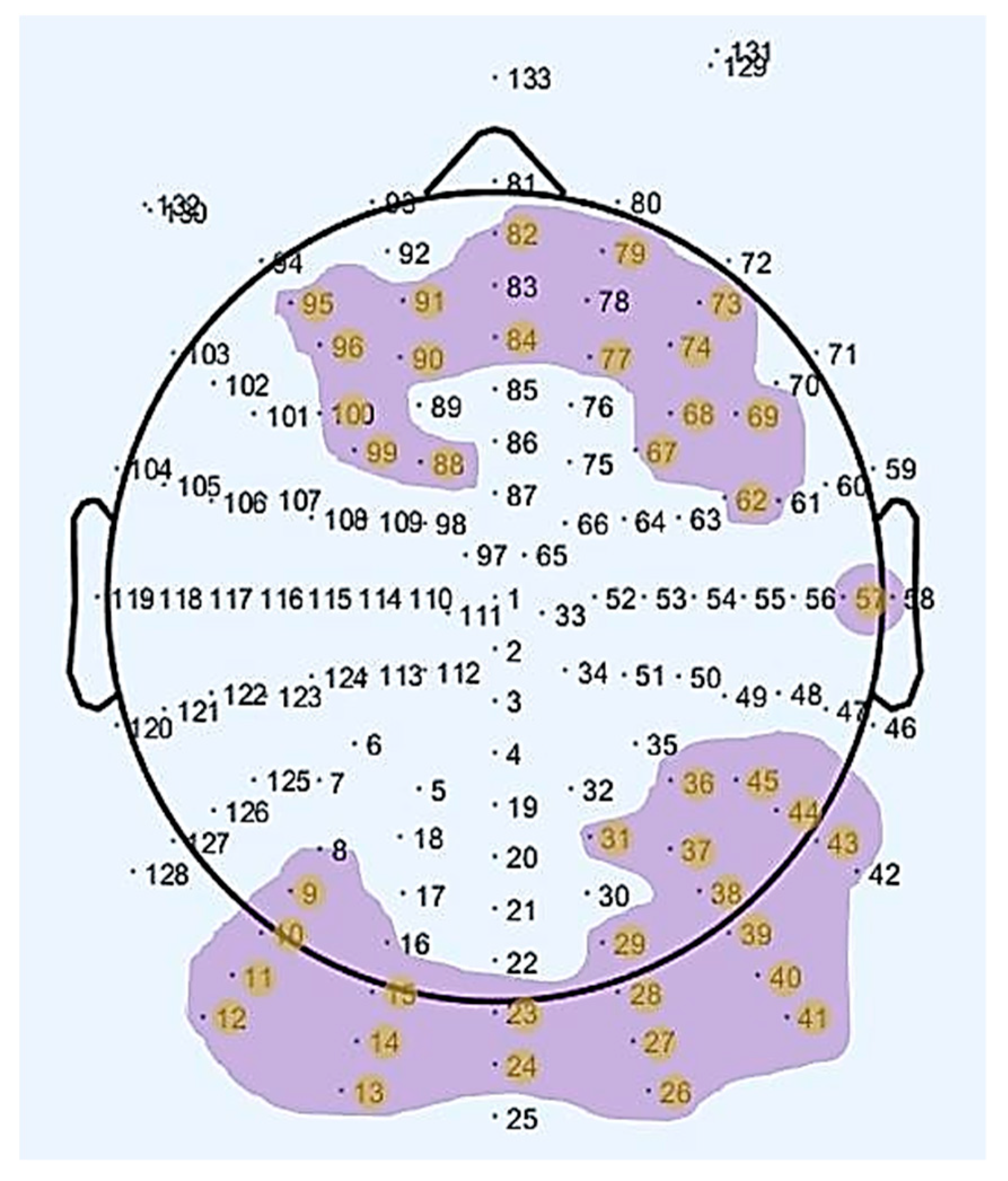 Entropy Free Full Text Aging Modulates The Resting Brain After A Memory Task A Validation Study From Multivariate Models Html