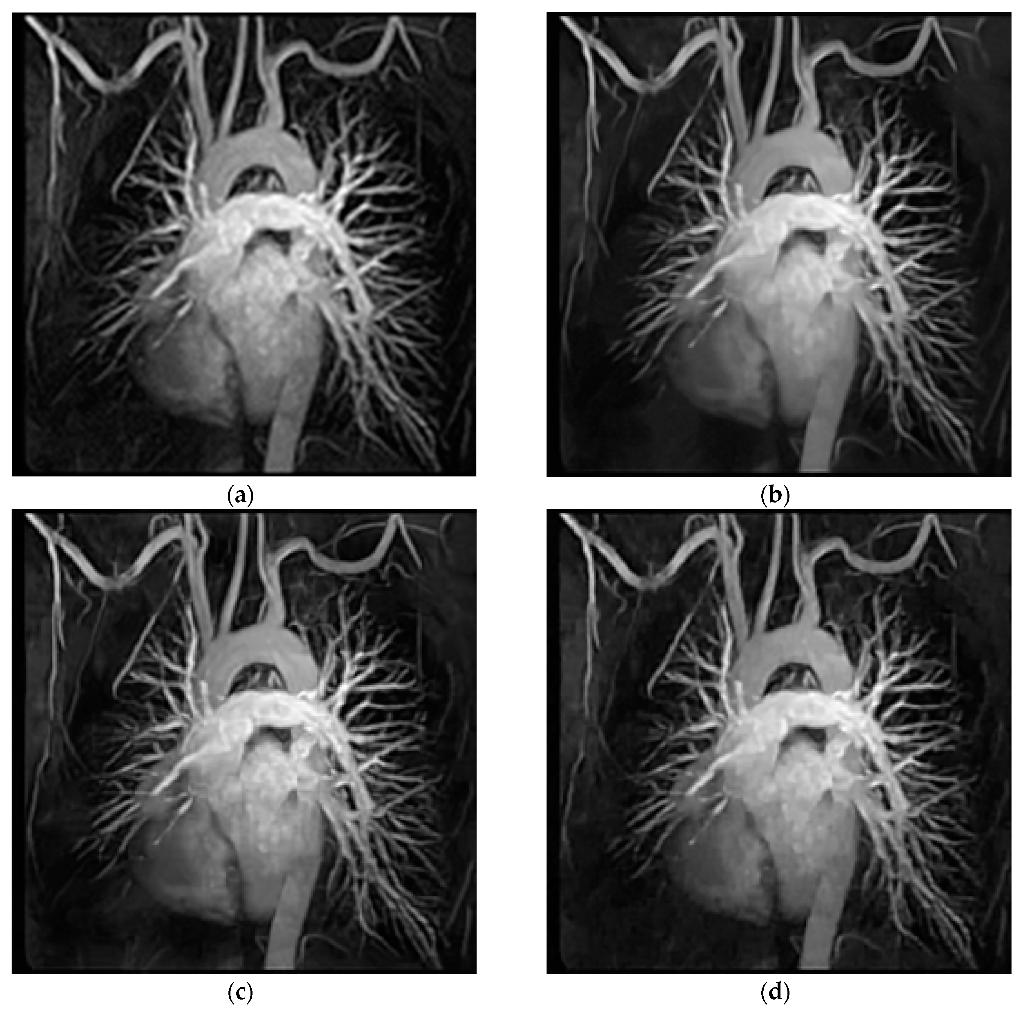 Entropy 21 00900 g007a