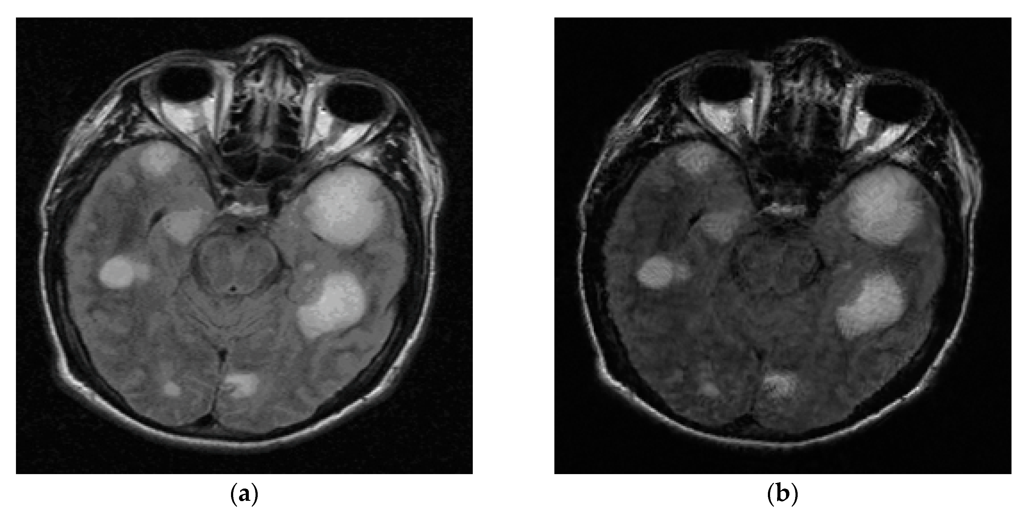 Entropy 21 00900 g014a