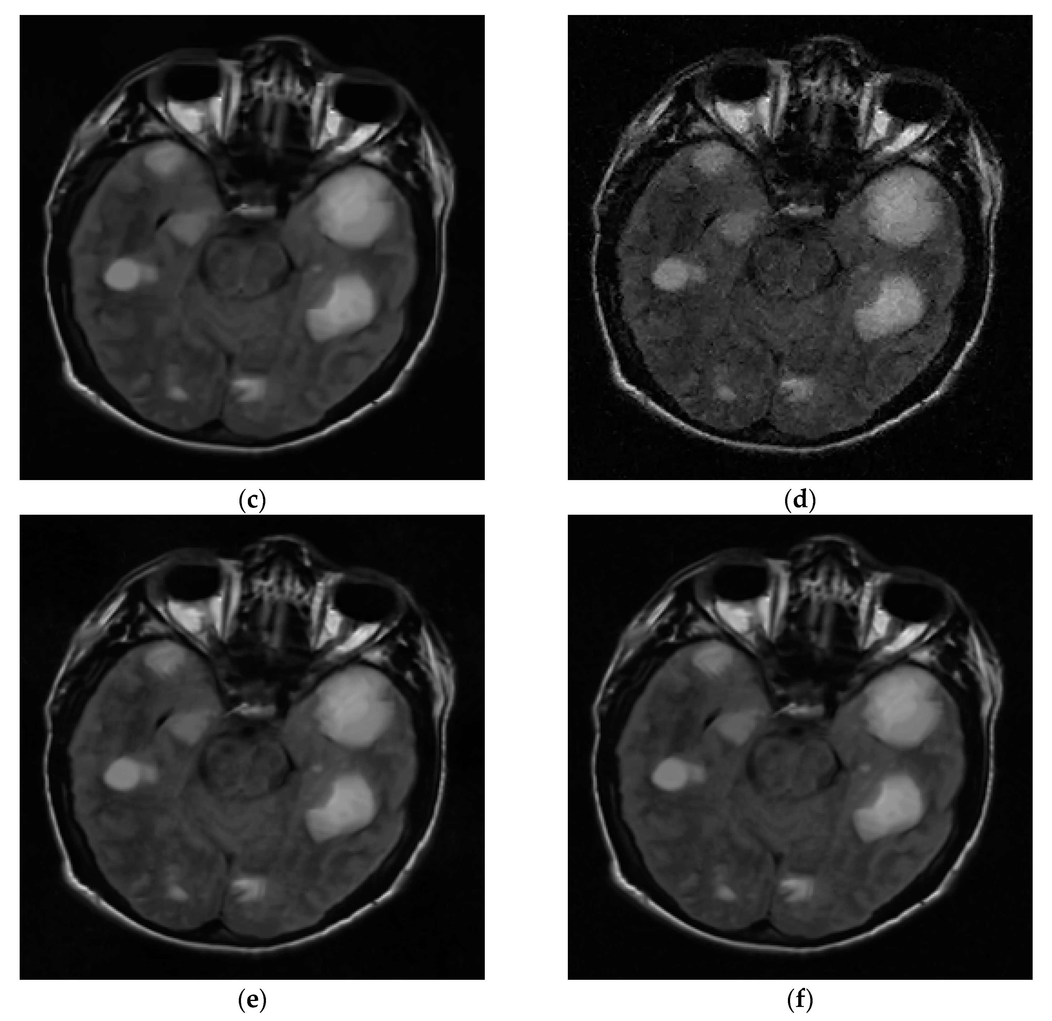 Entropy 21 00900 g014b