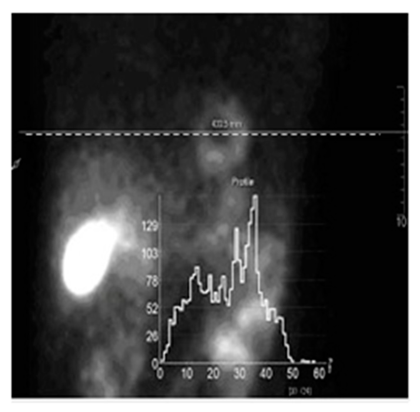 Entropy 21 01108 g001