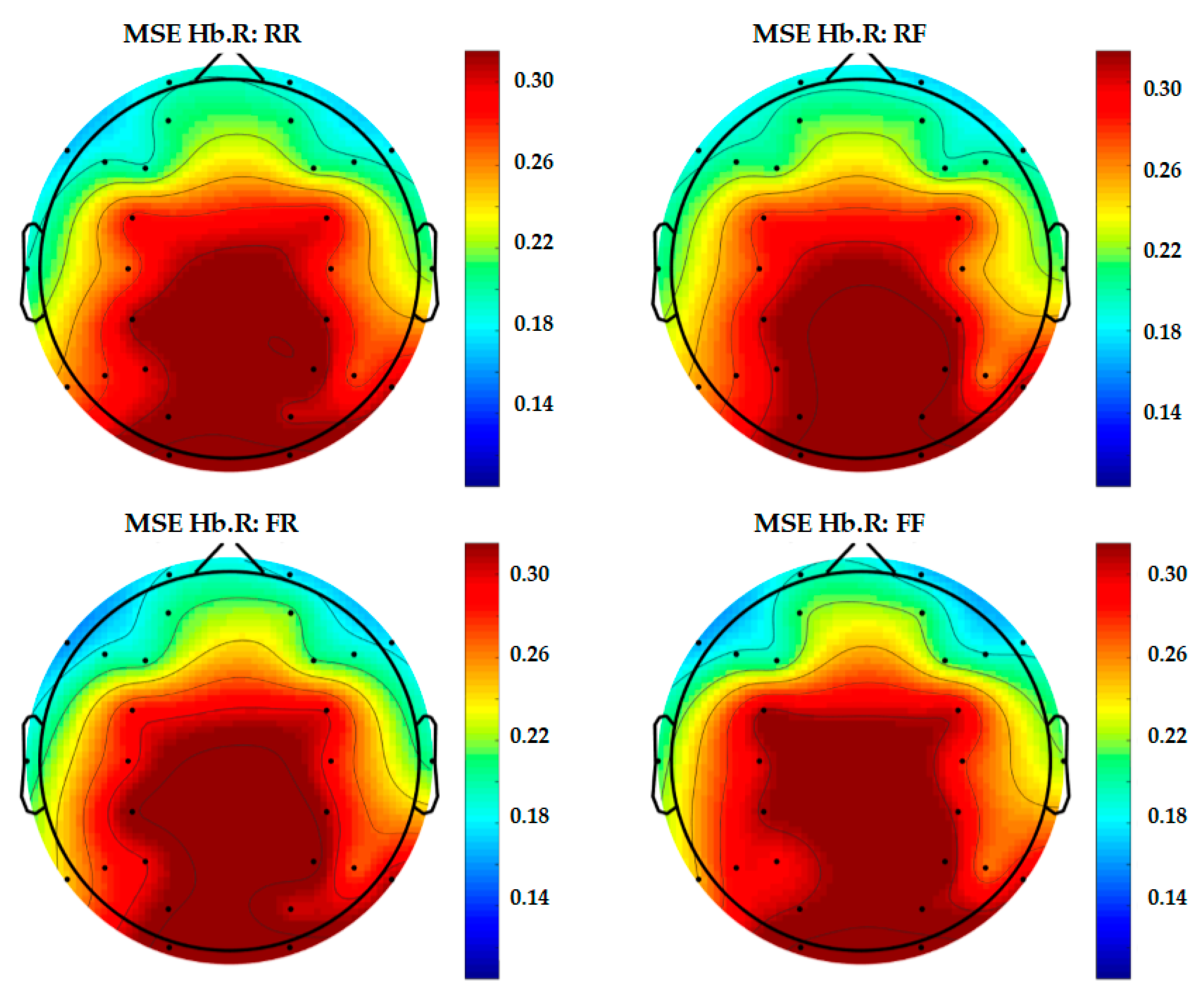 Entropy 22 00189 g011