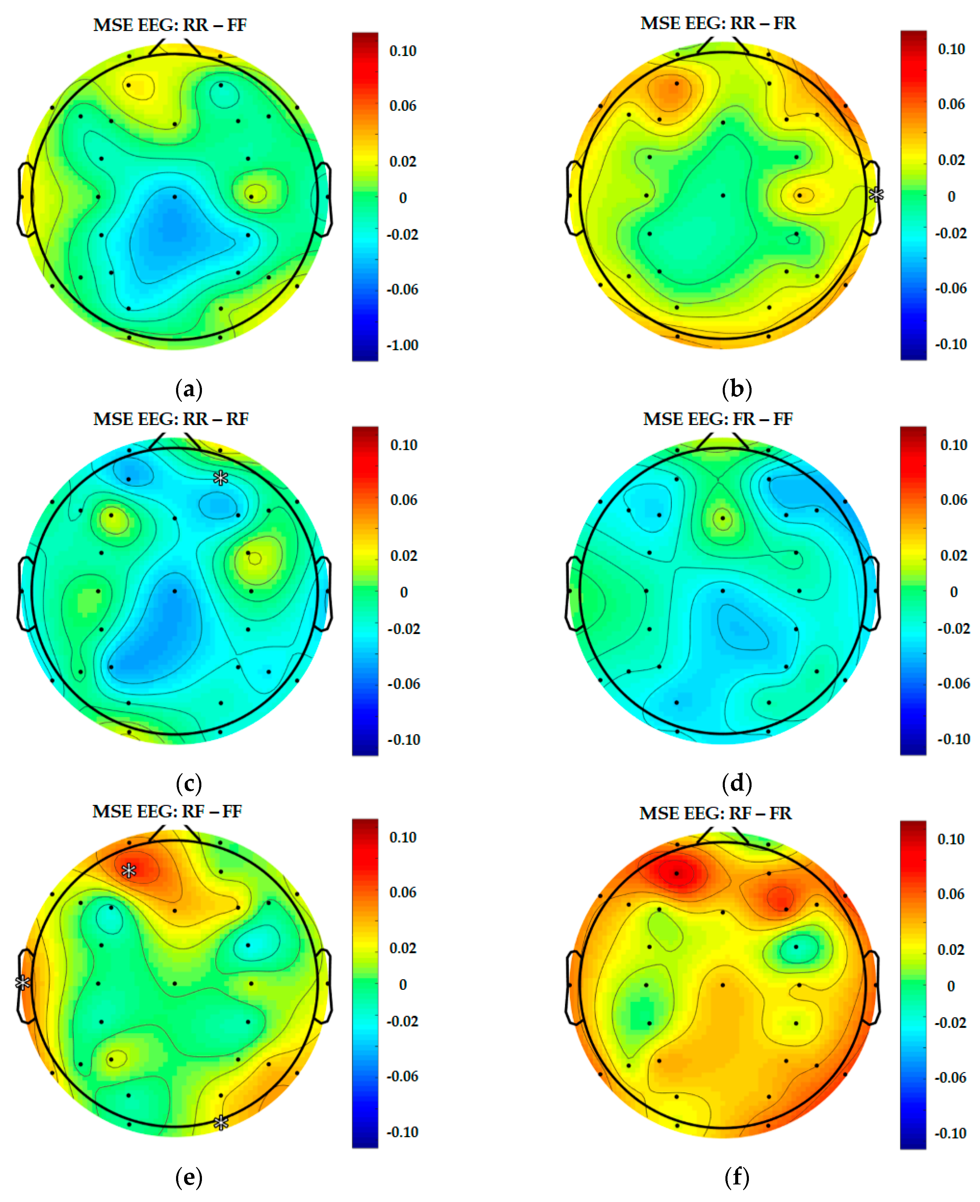 Entropy Free Full Text Multiscale Entropy As A New Feature For Eeg And Fnirs Analysis Html