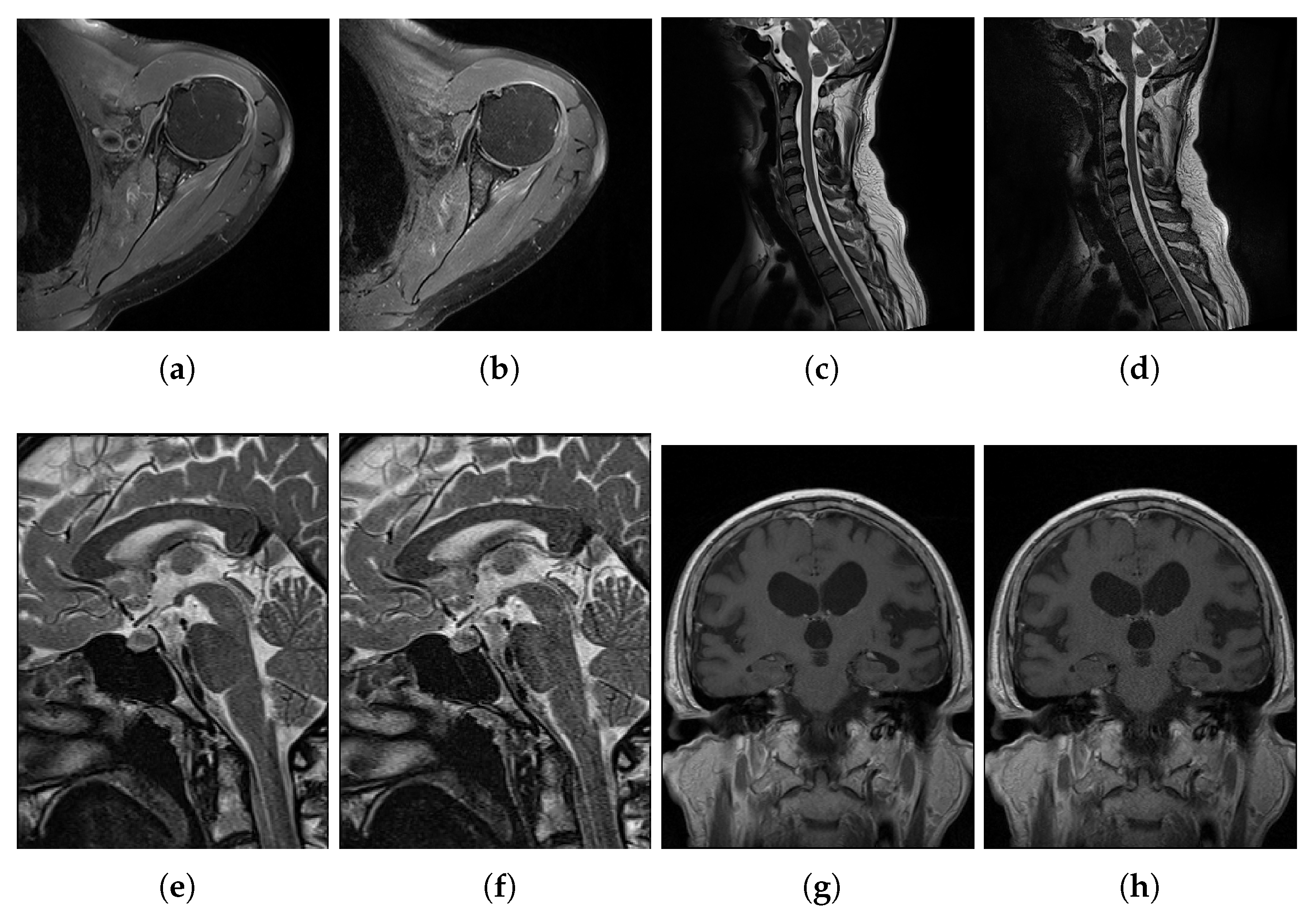 Entropy 22 00220 g003 Entropy 22 00220 g003