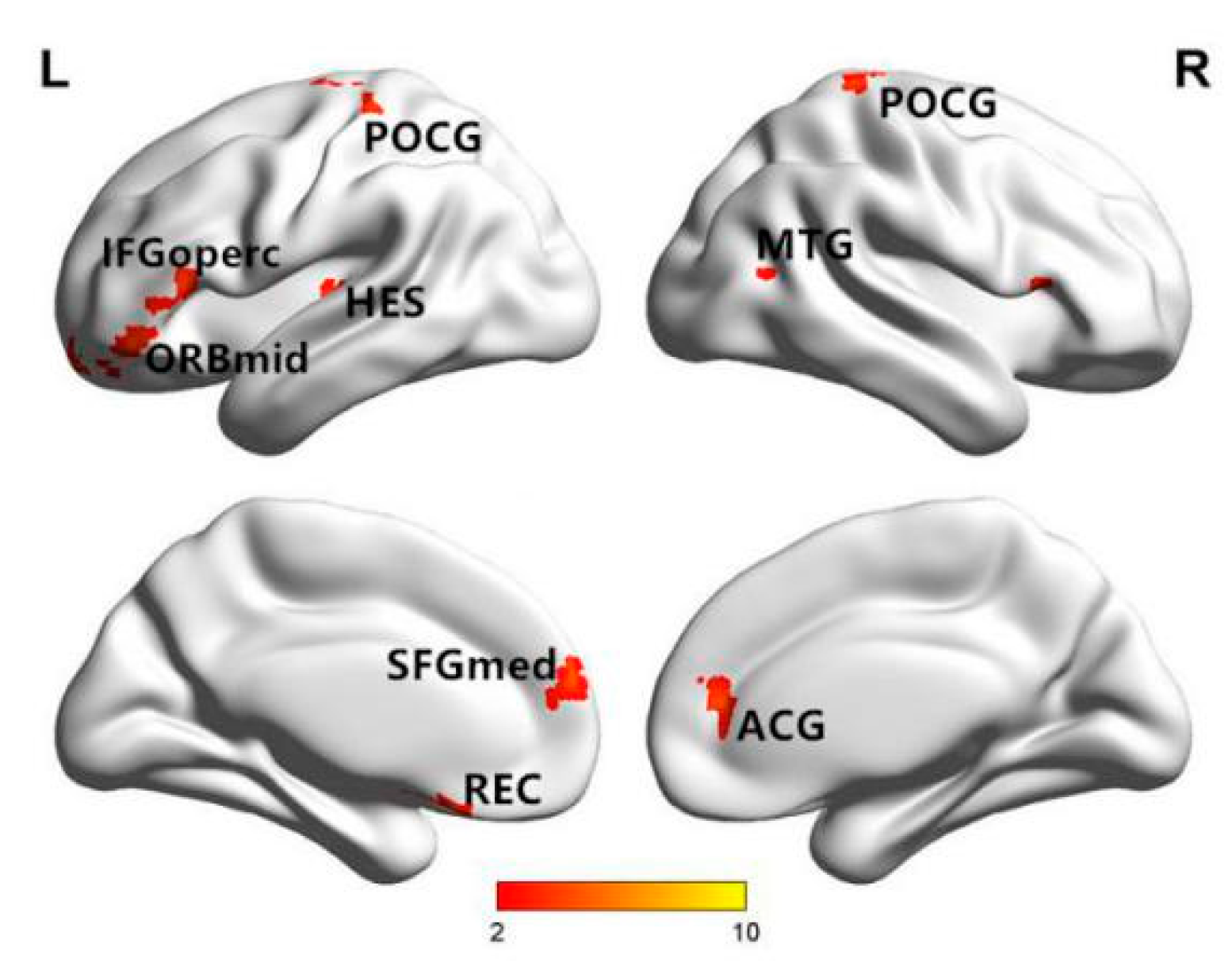 Entropy 22 00239 g007