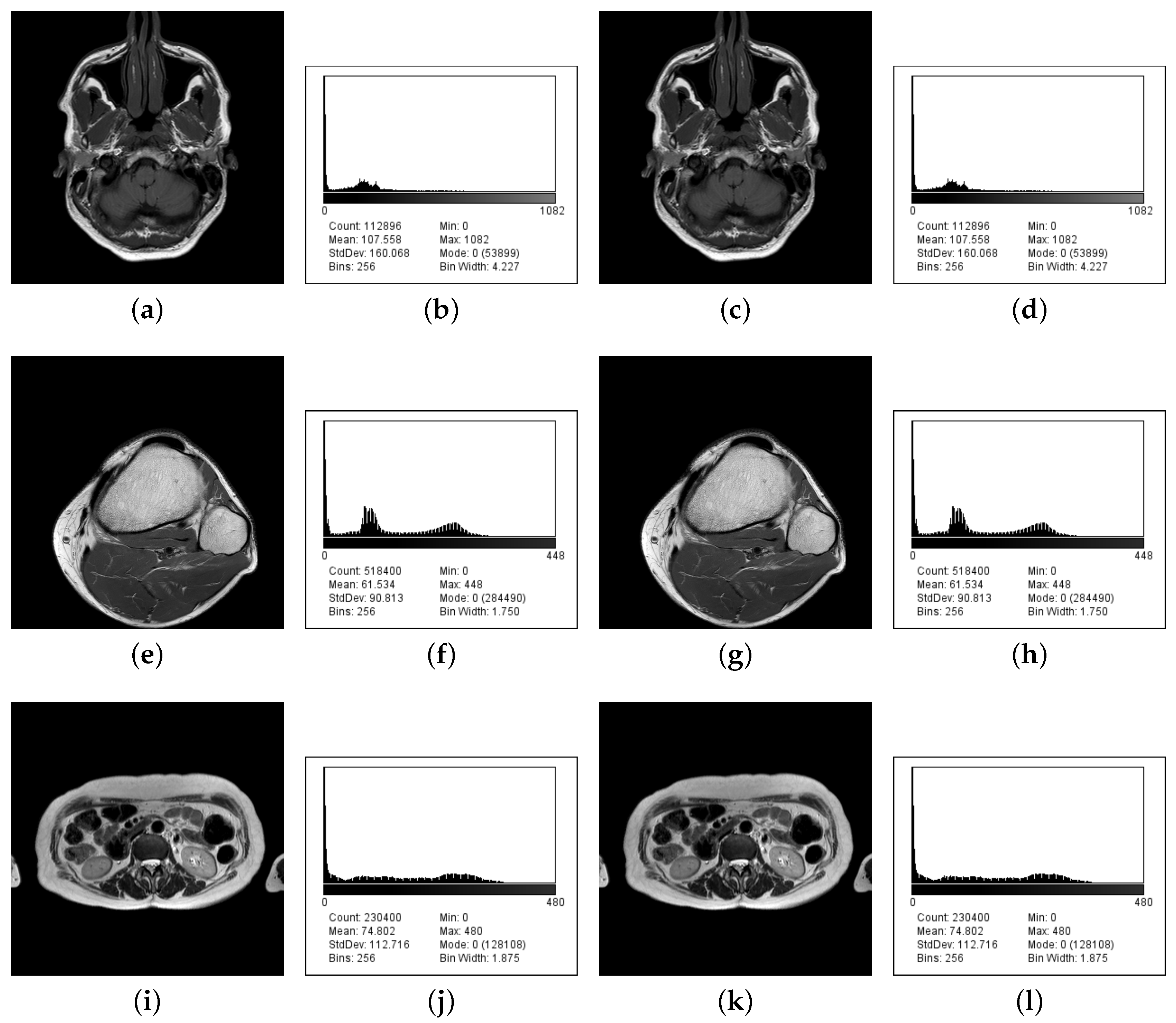 Entropy 22 00501 g004