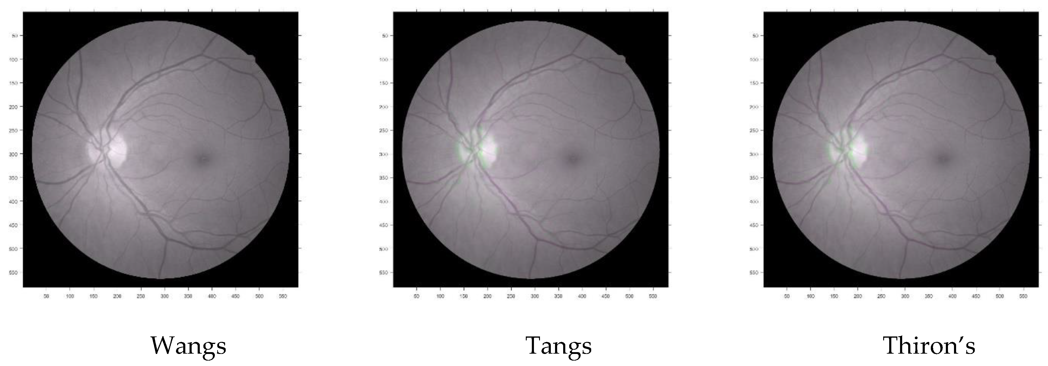 Entropy 22 00659 g016 Entropy 22 00659 g016