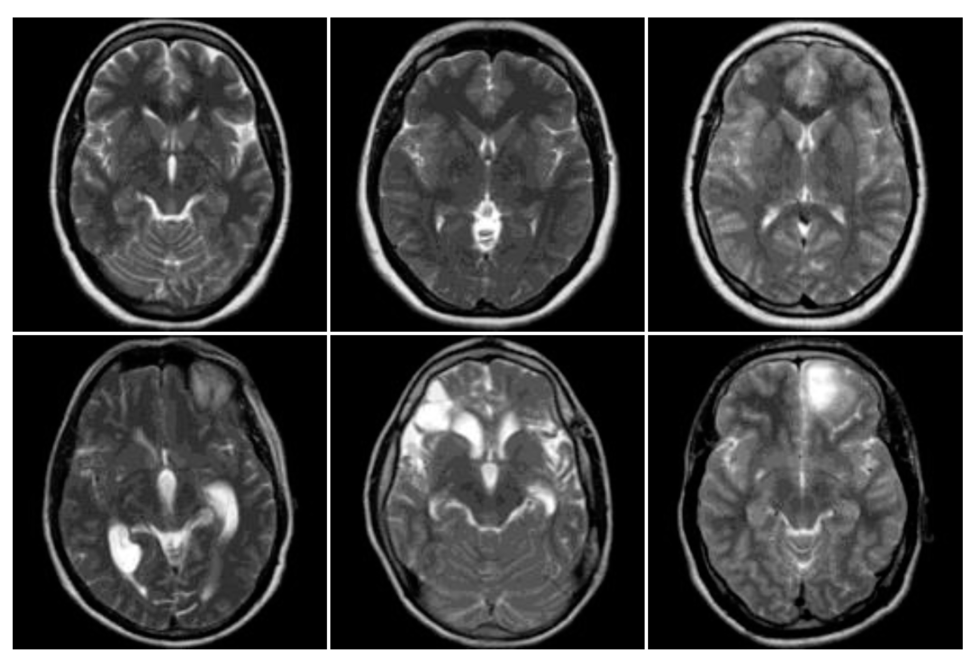 Entropy 22 01033 g003 Entropy 22 01033 g003