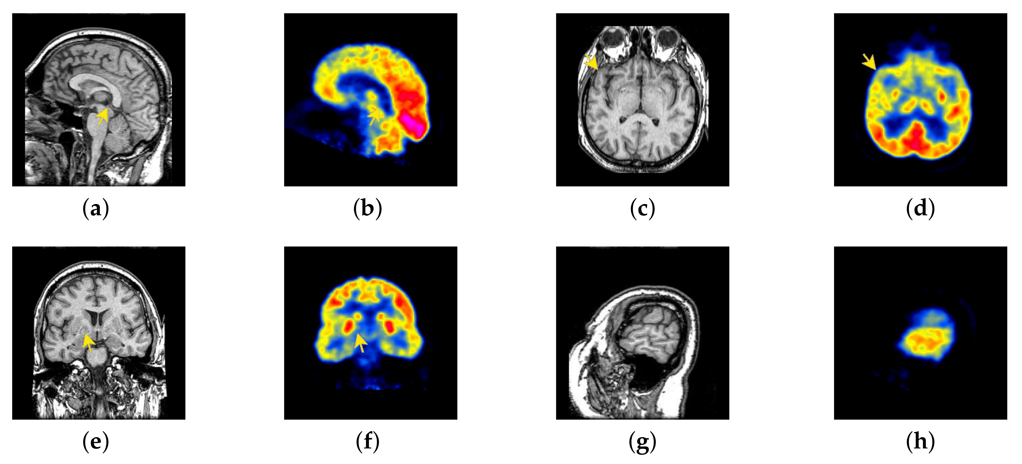 Entropy 22 01423 g024