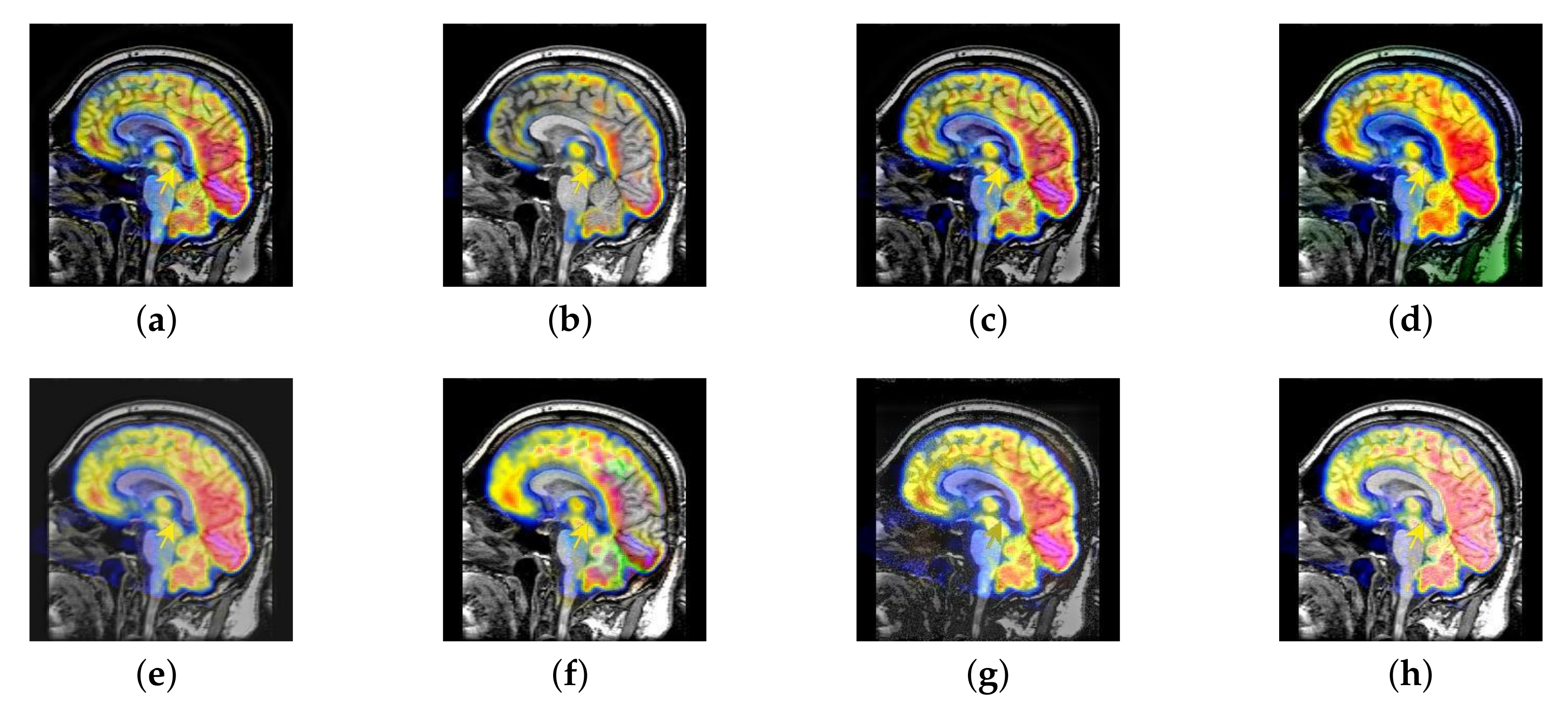 Entropy 22 01423 g025
