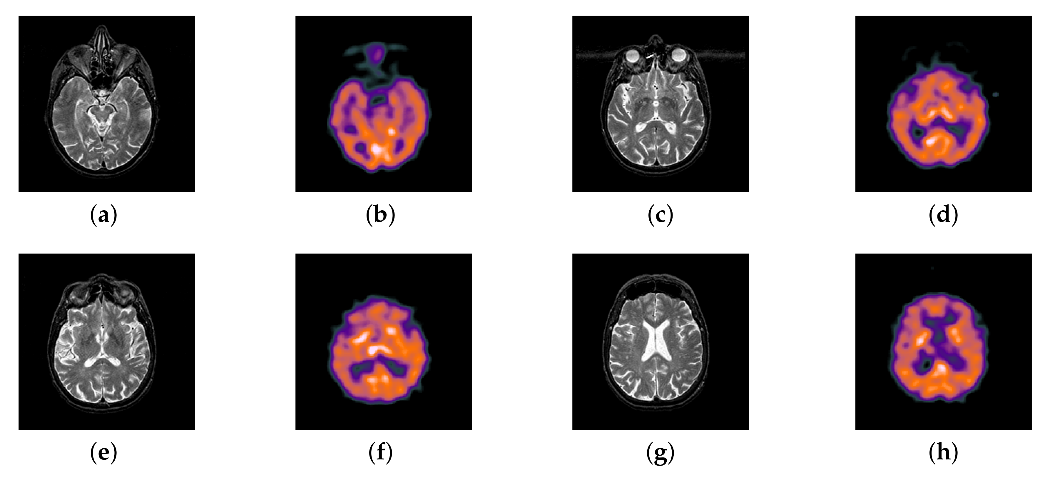 Entropy 22 01423 g041