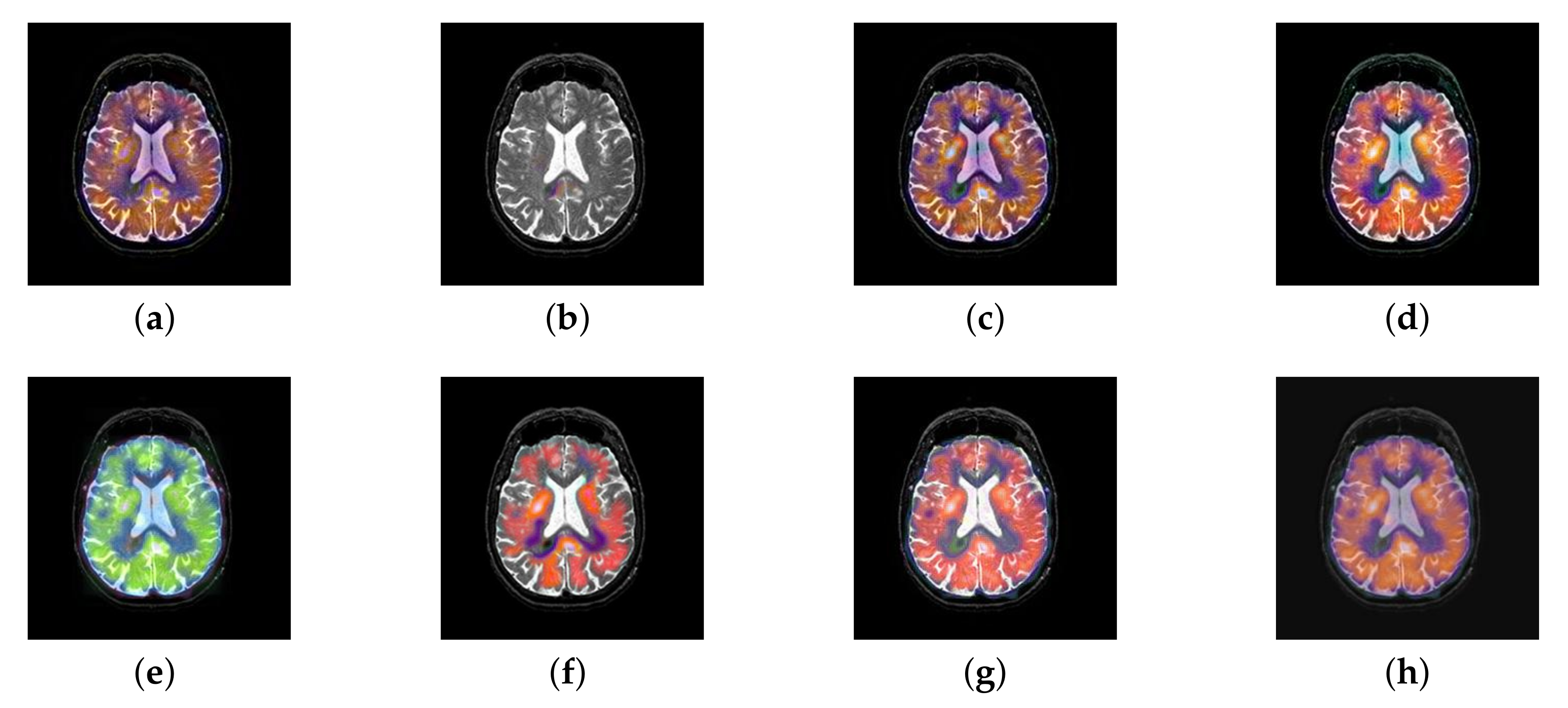 Entropy 22 01423 g045