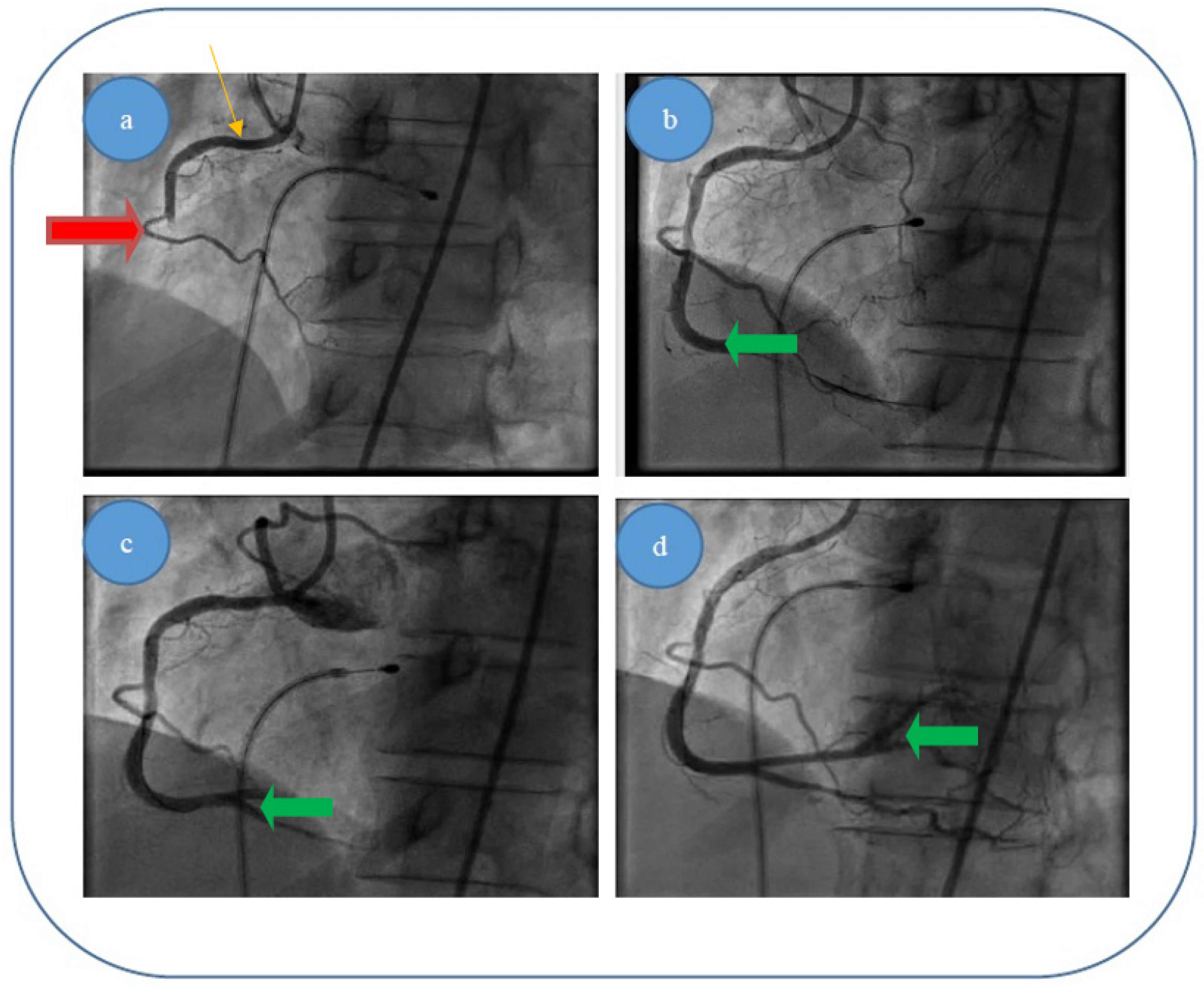 Entropy 23 00444 g006 550