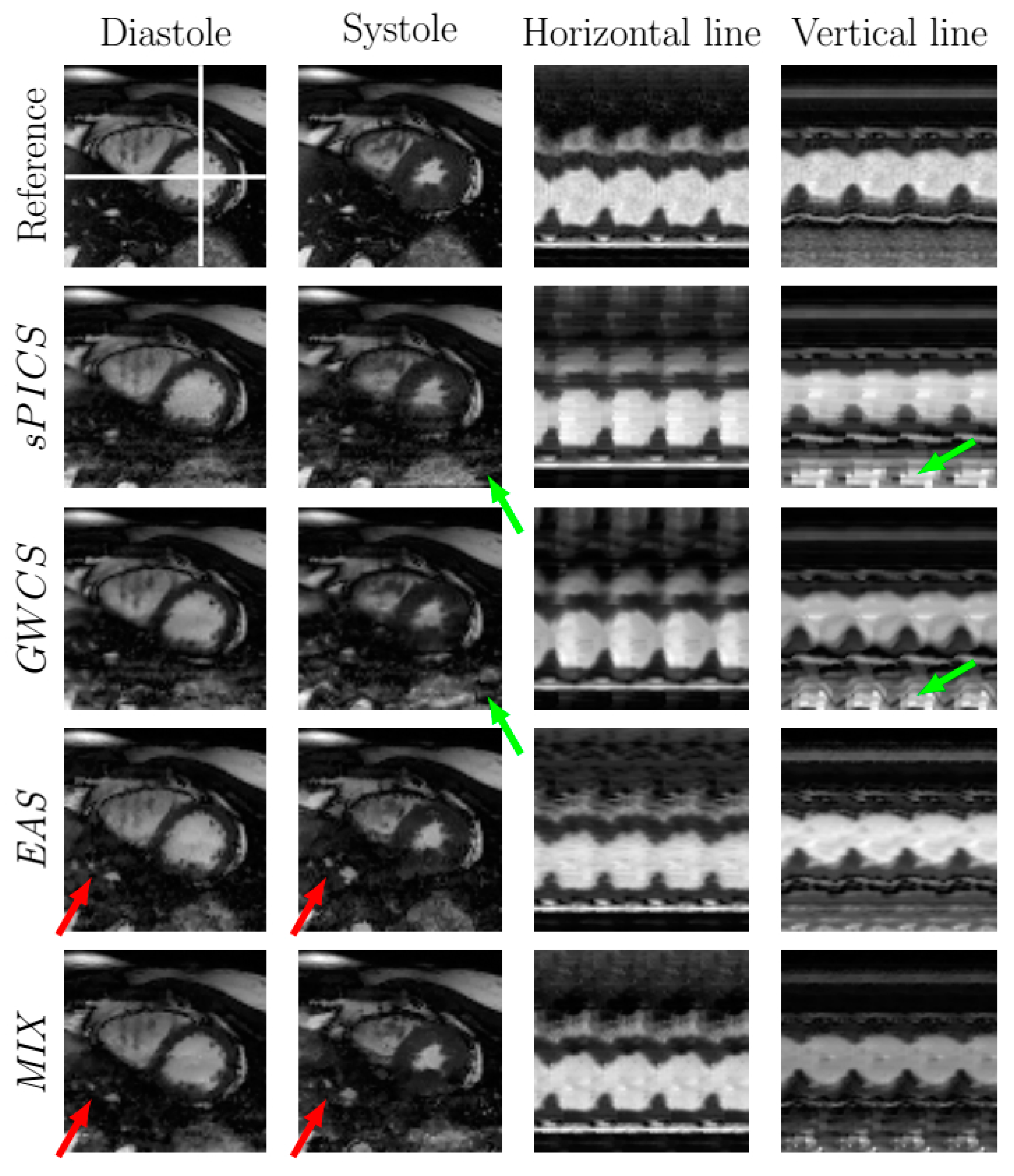 Entropy 23 00555 g006 Entropy 23 00555 g006
