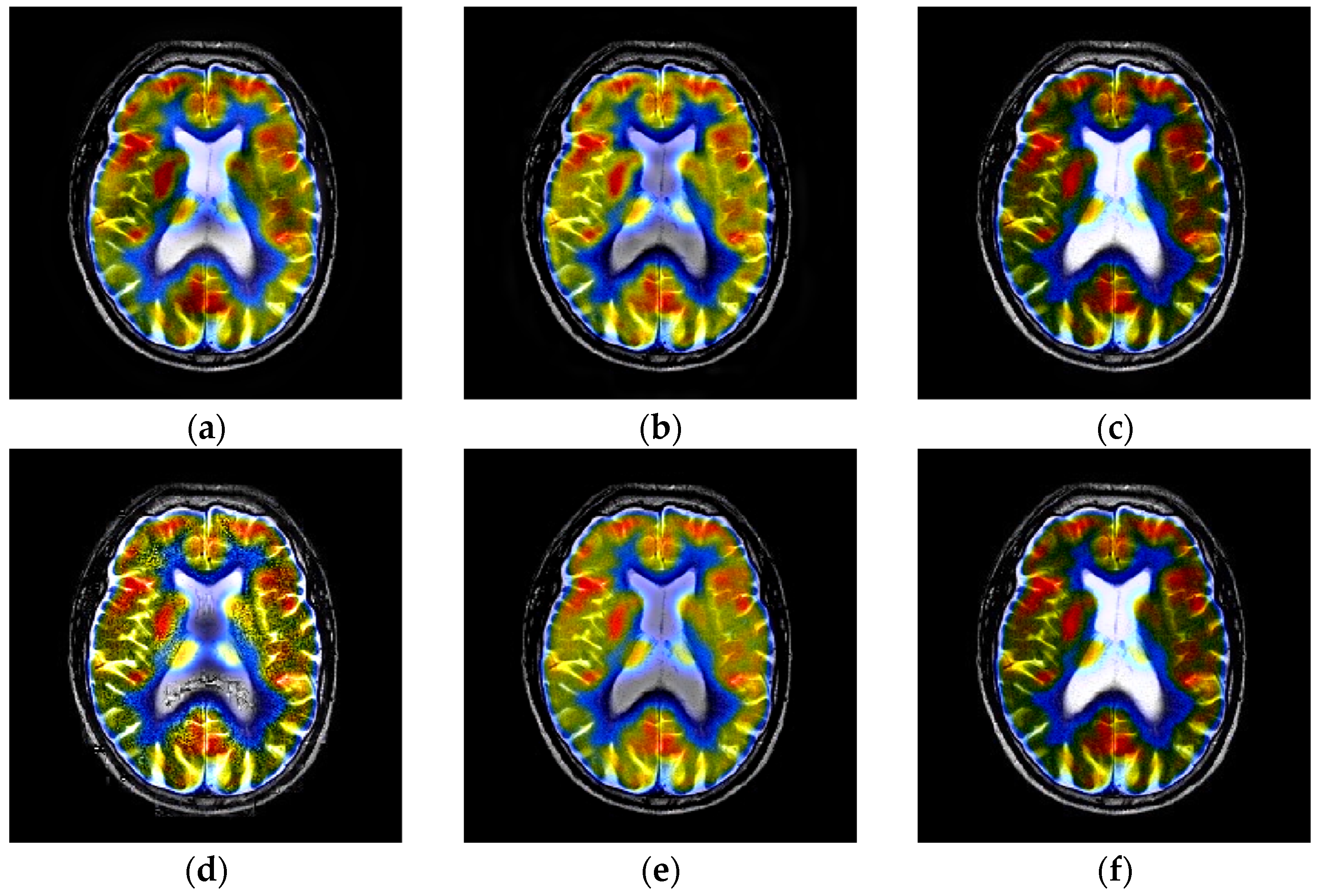 Entropy 23 00591 g011a Entropy 23 00591 g011a