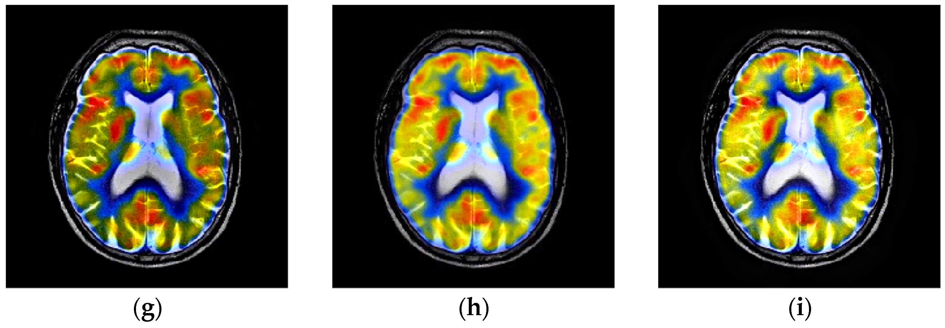 Entropy 23 00591 g011b Entropy 23 00591 g011b