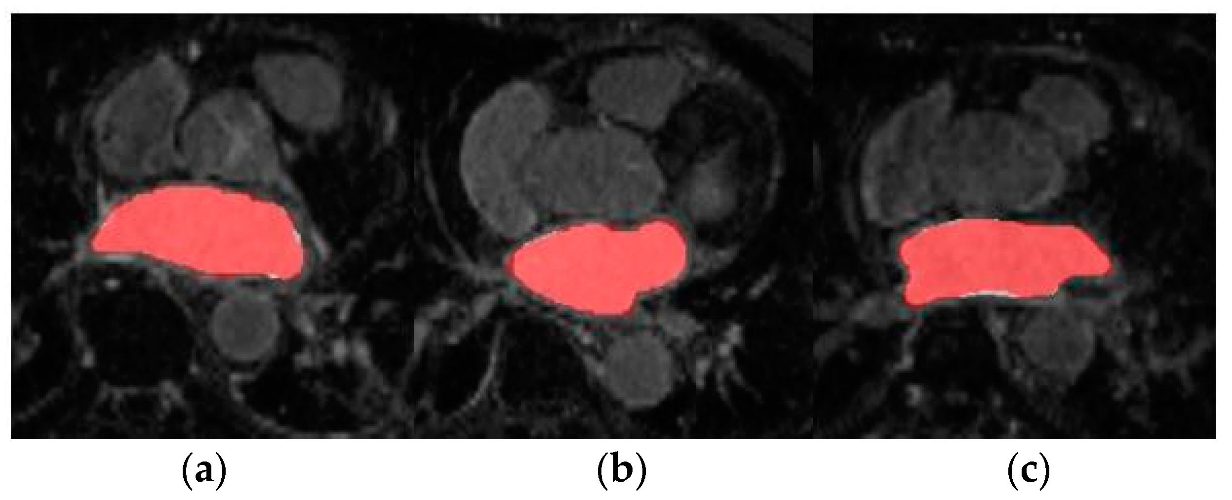 Entropy 23 00898 g004