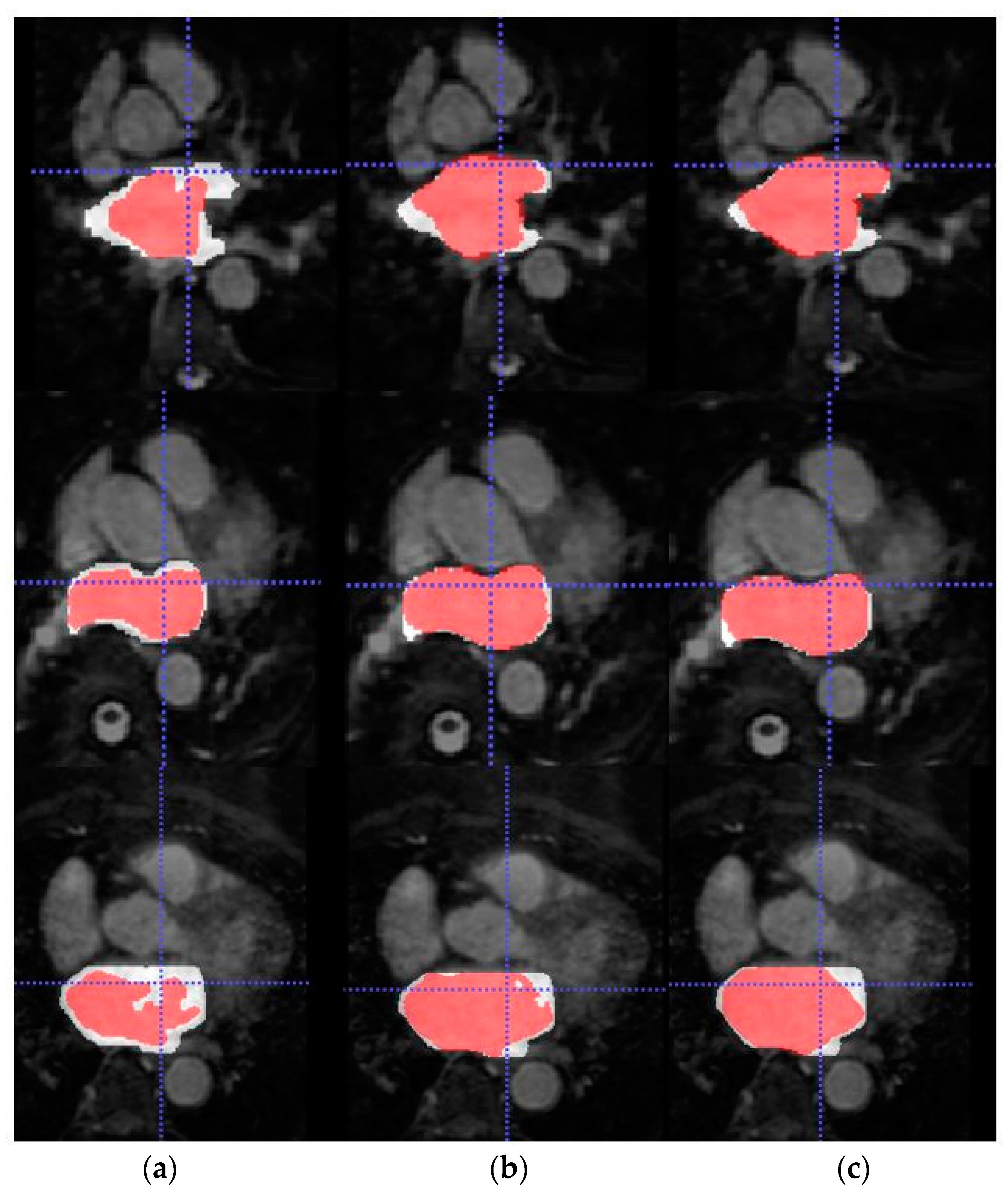 Entropy 23 00898 g005