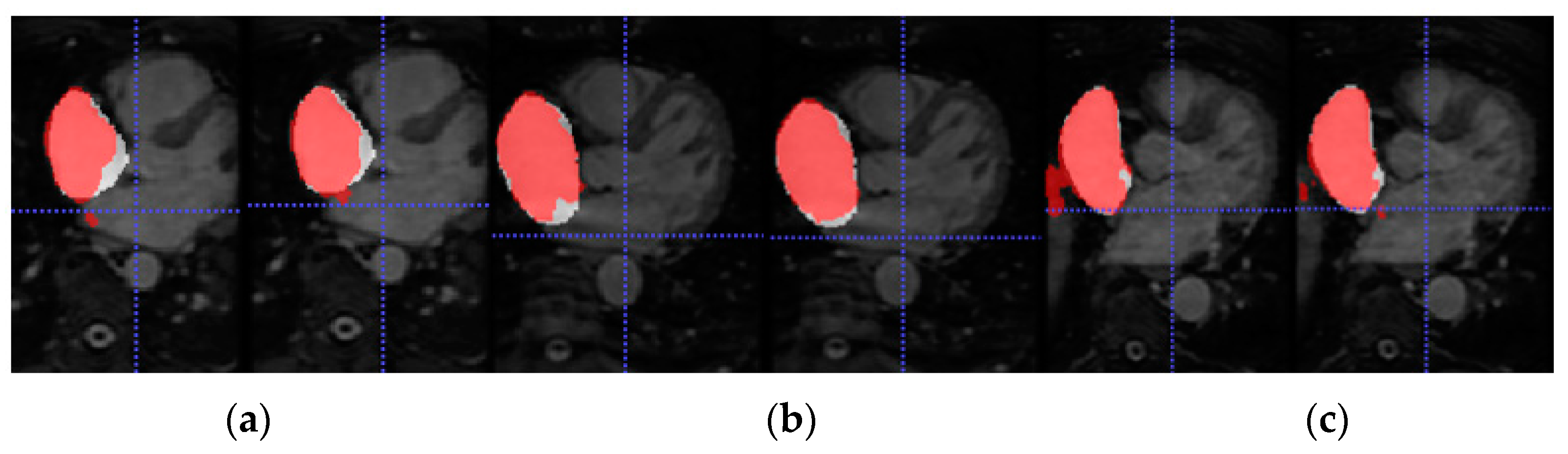 Entropy 23 00898 g006