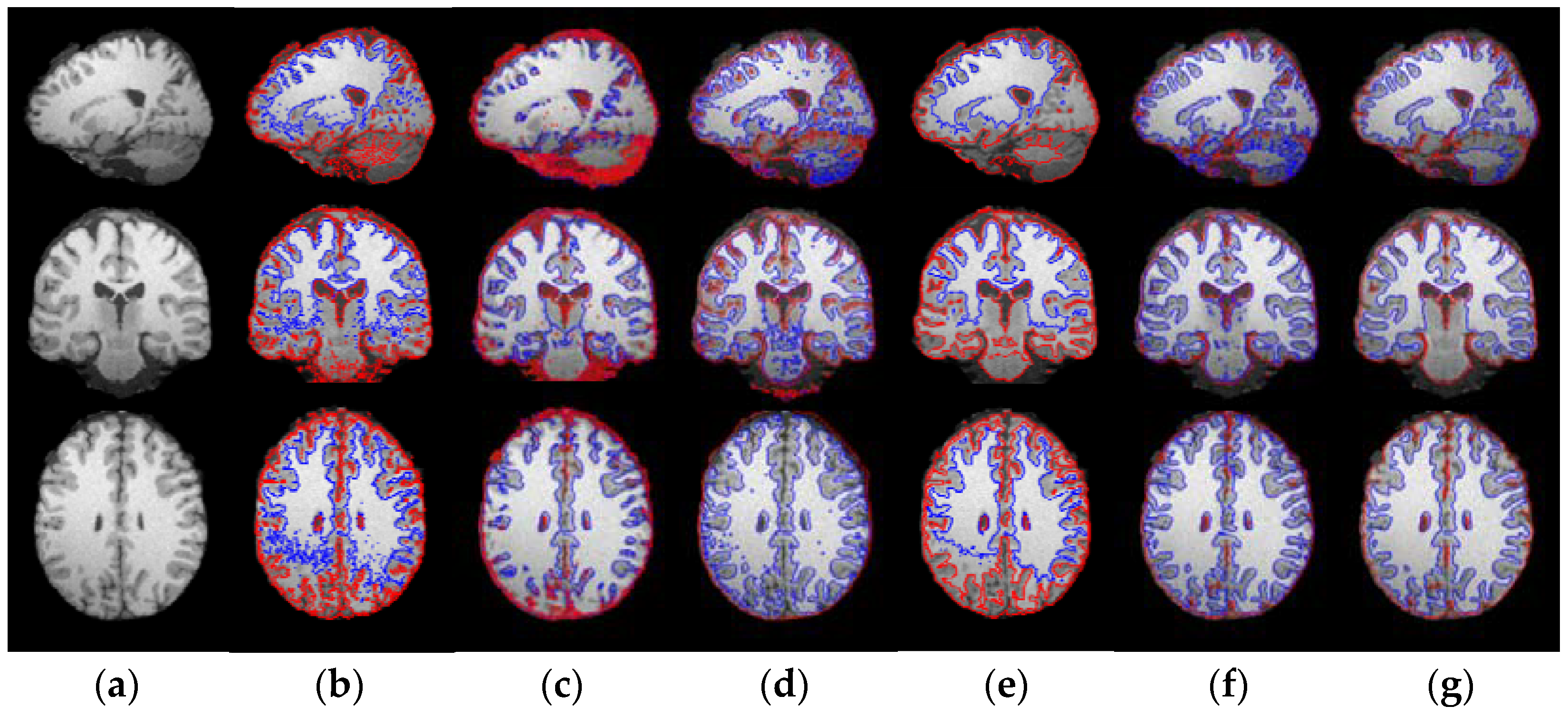 Entropy 23 01196 g011
