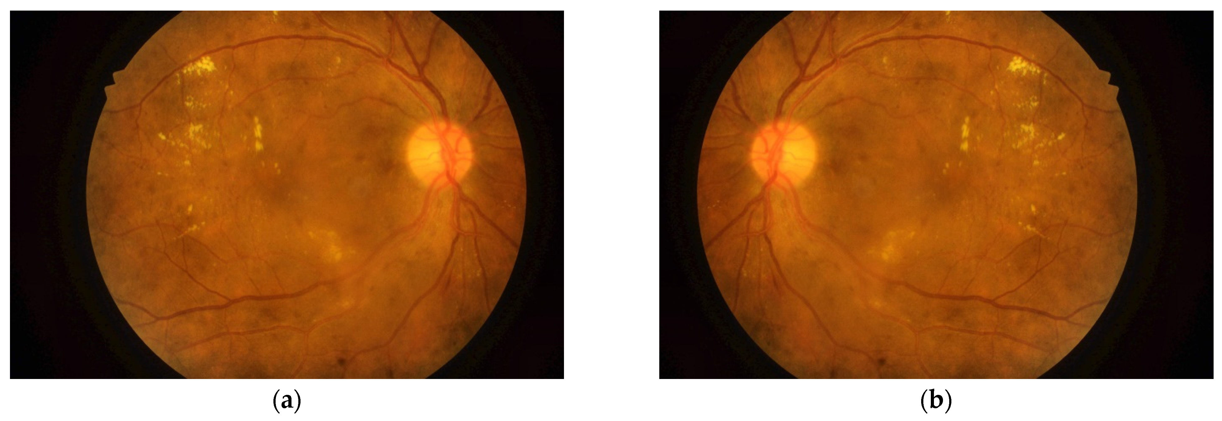 Entropy 23 01251 g004