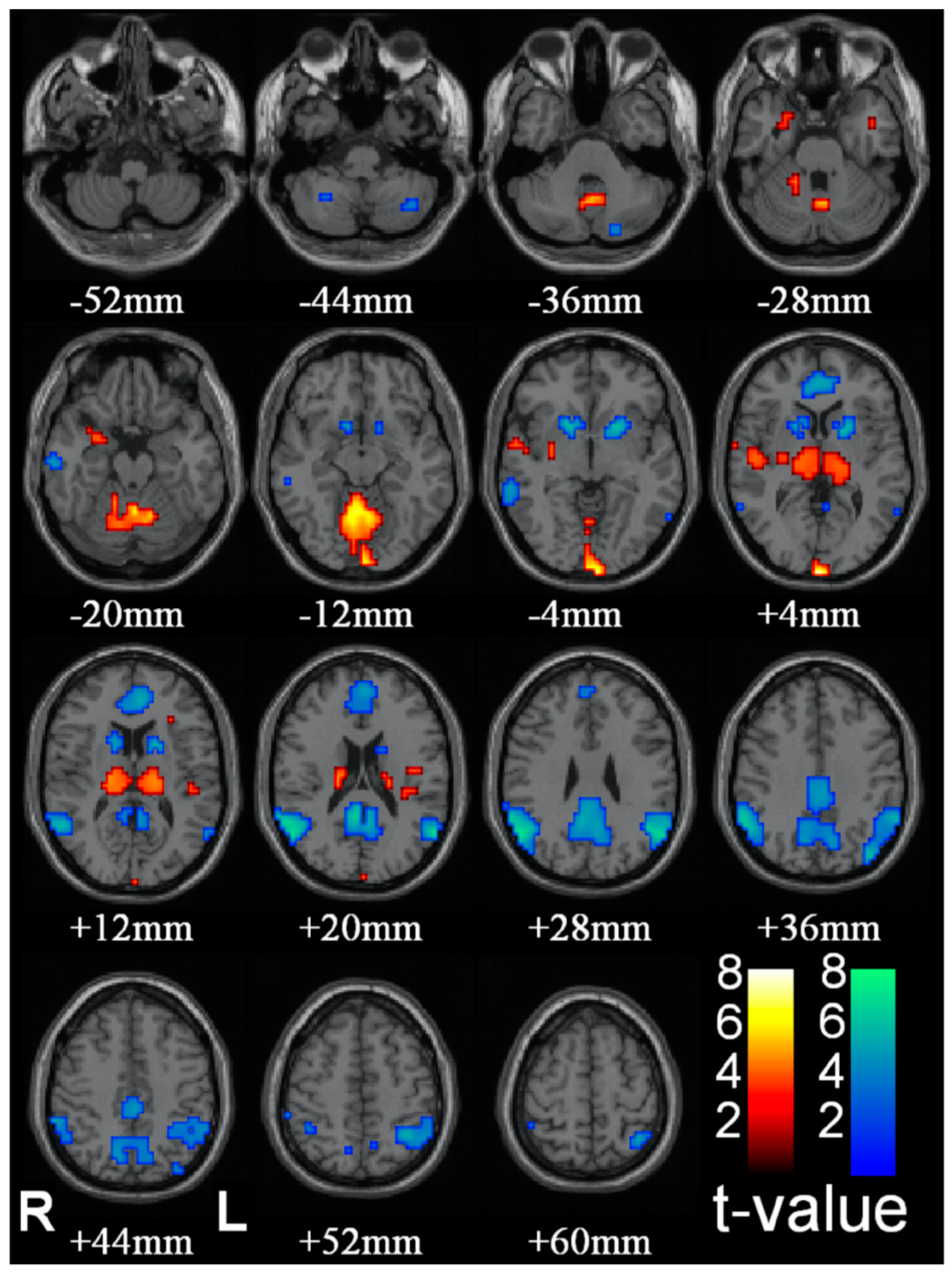 Entropy 23 01443 g004