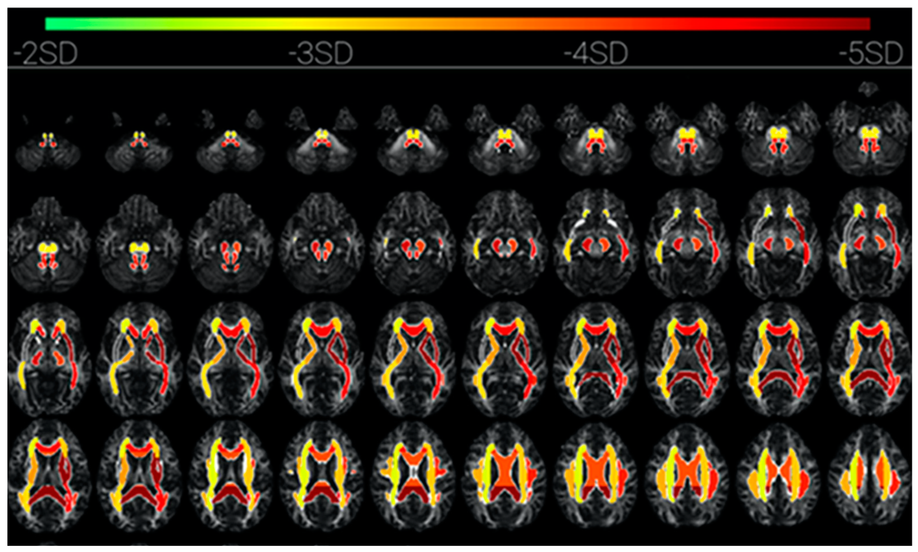 Entropy 23 01443 g007