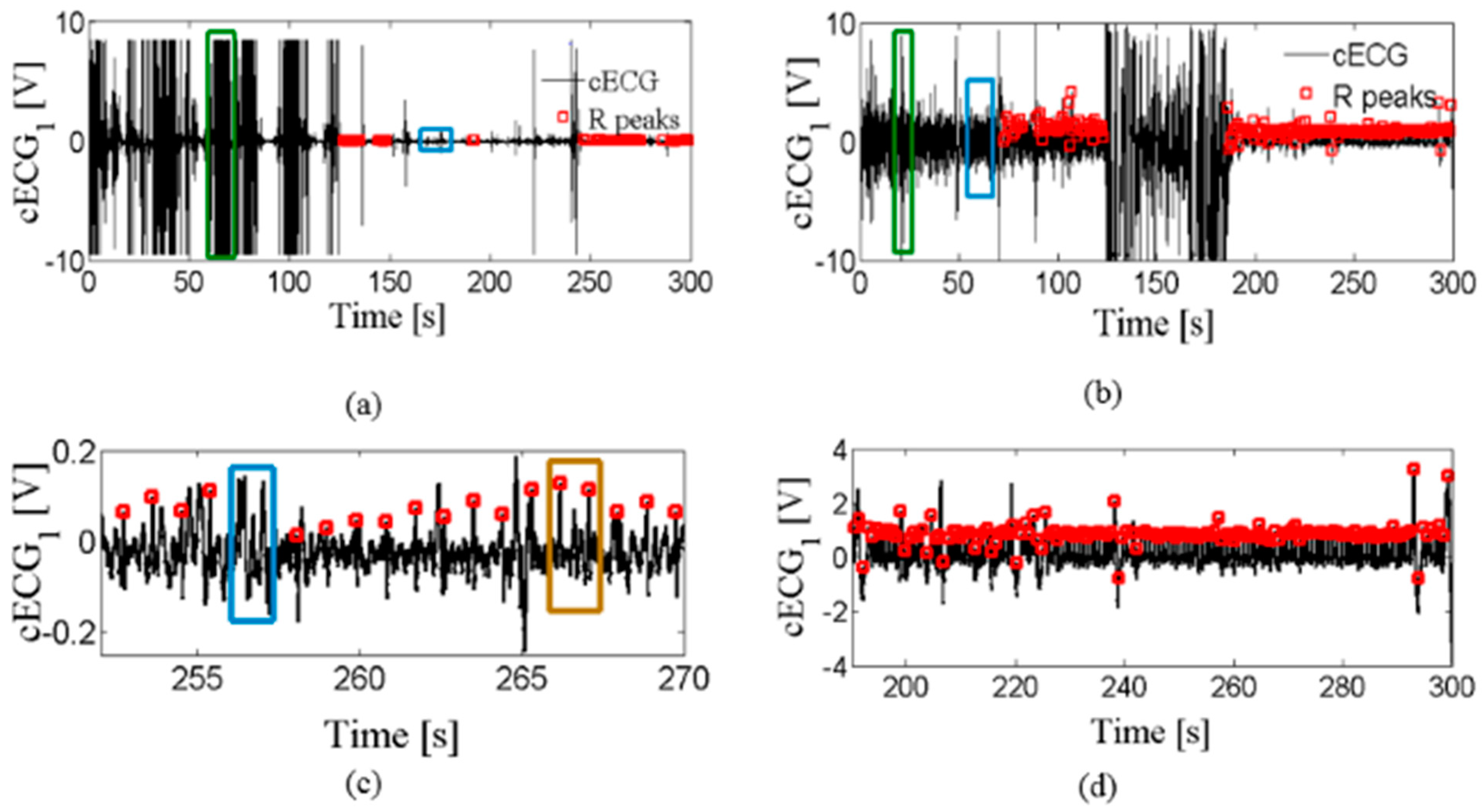 Entropy Free Full Text Reduction Of Artifacts In Capacitive Electrocardiogram Signals Of Driving Subjects Html