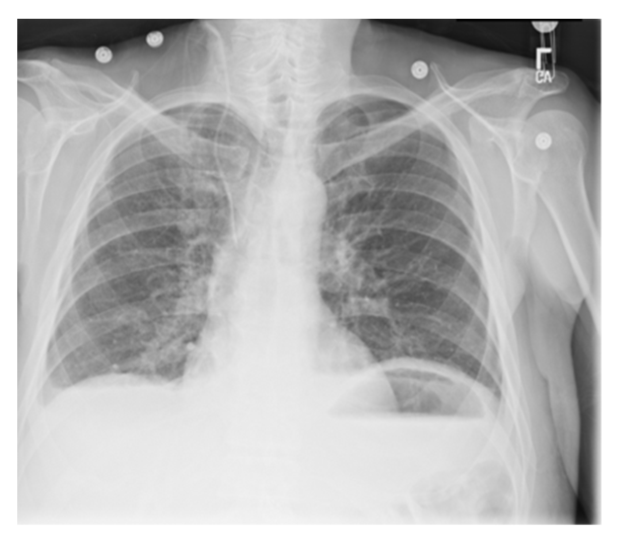 Entropy 24 00375 g009 550