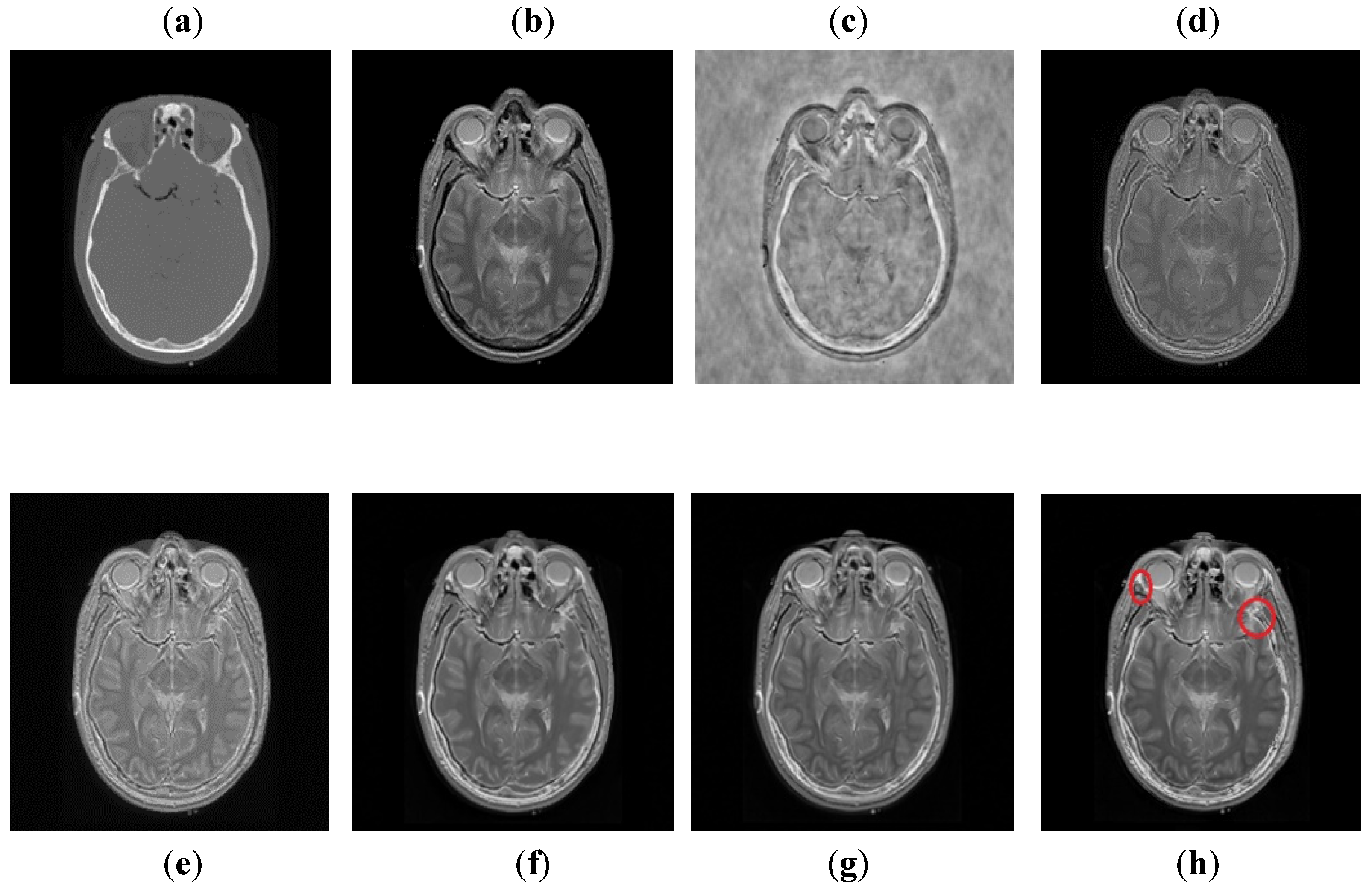 Entropy 24 00393 g010 550