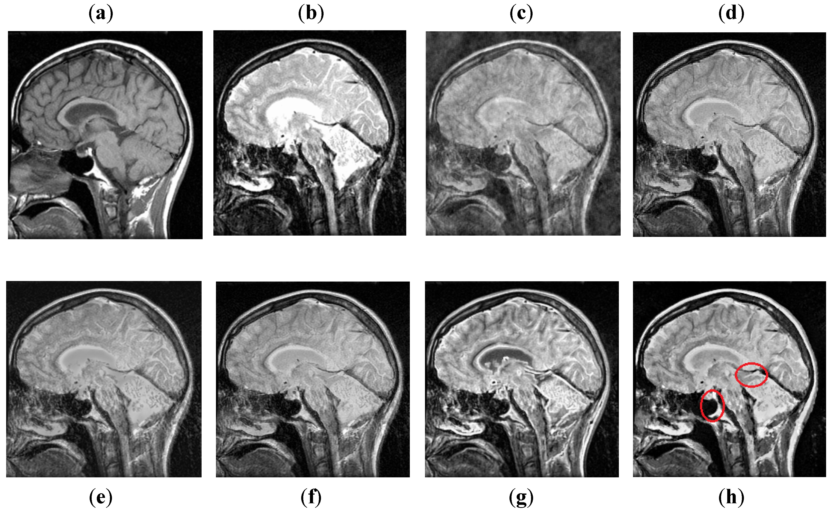 Entropy 24 00393 g012 550