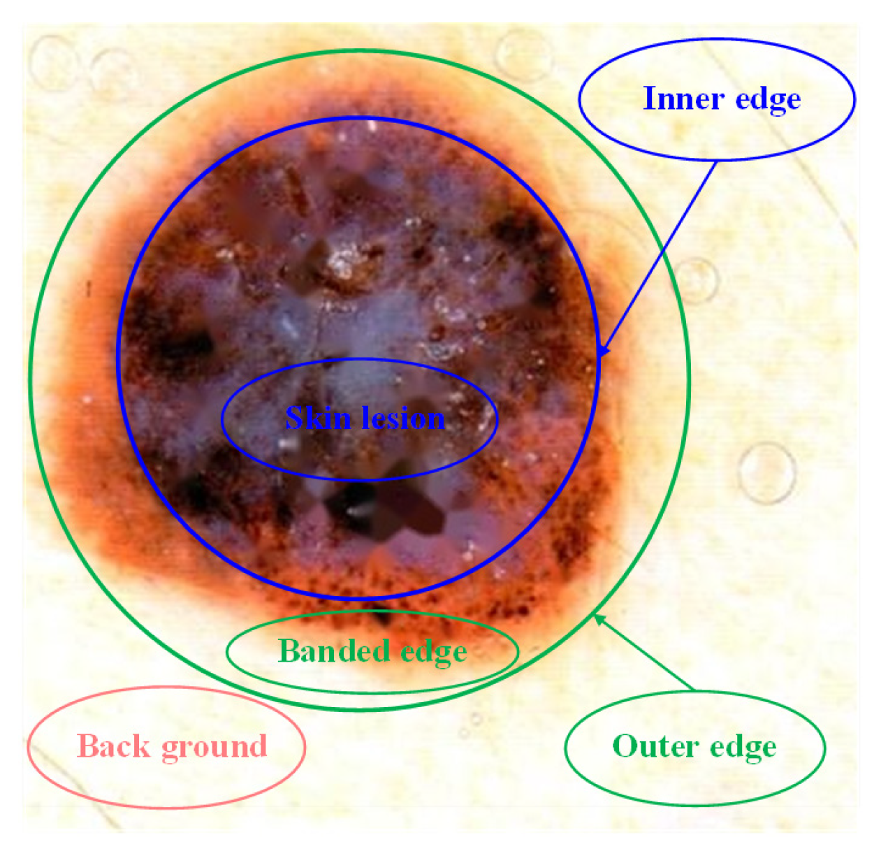 Entropy 24 00783 g003