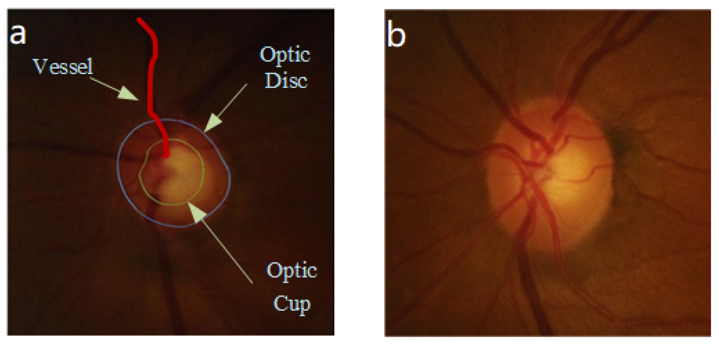 Entropy 24 00796 g001 550