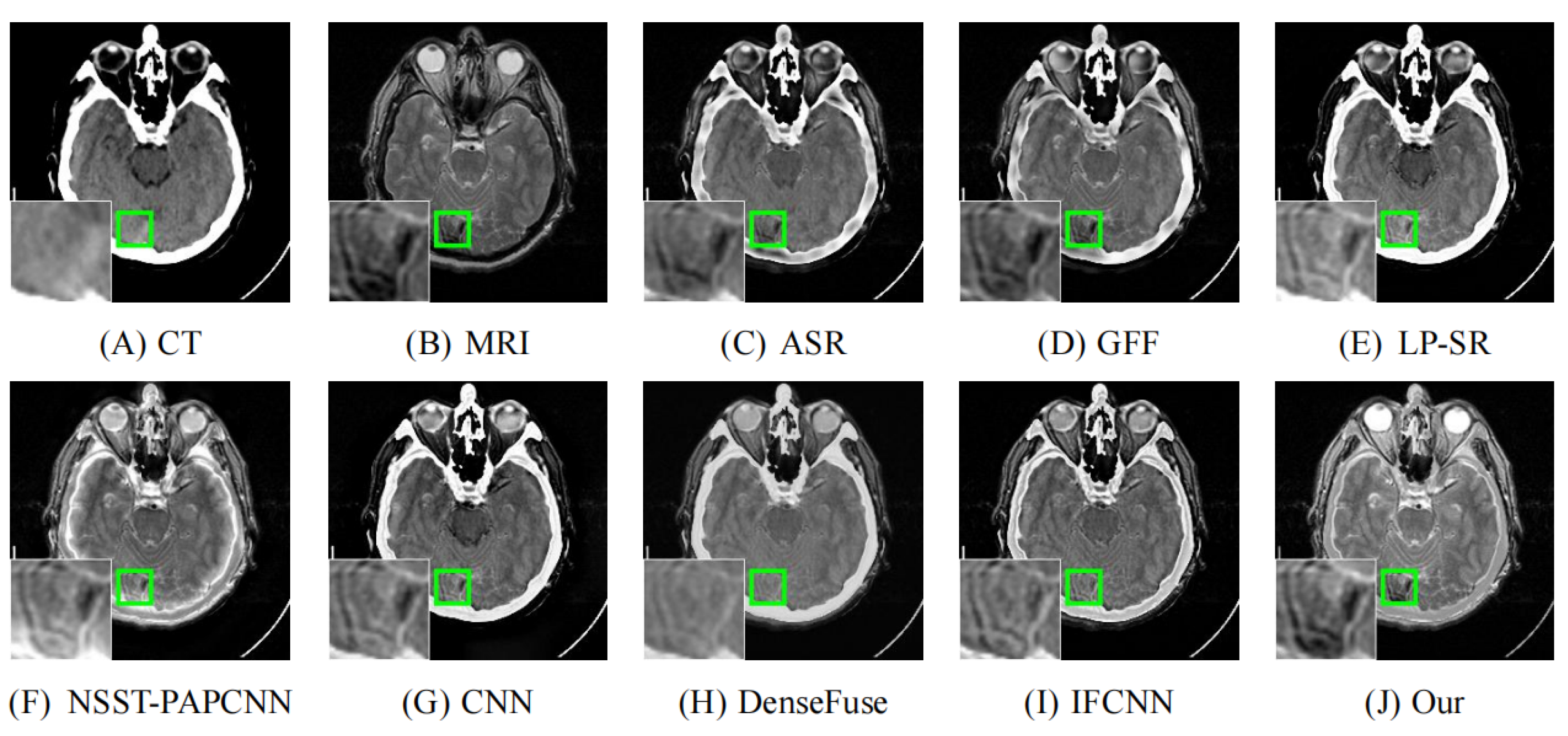 Entropy 24 00843 g008 550