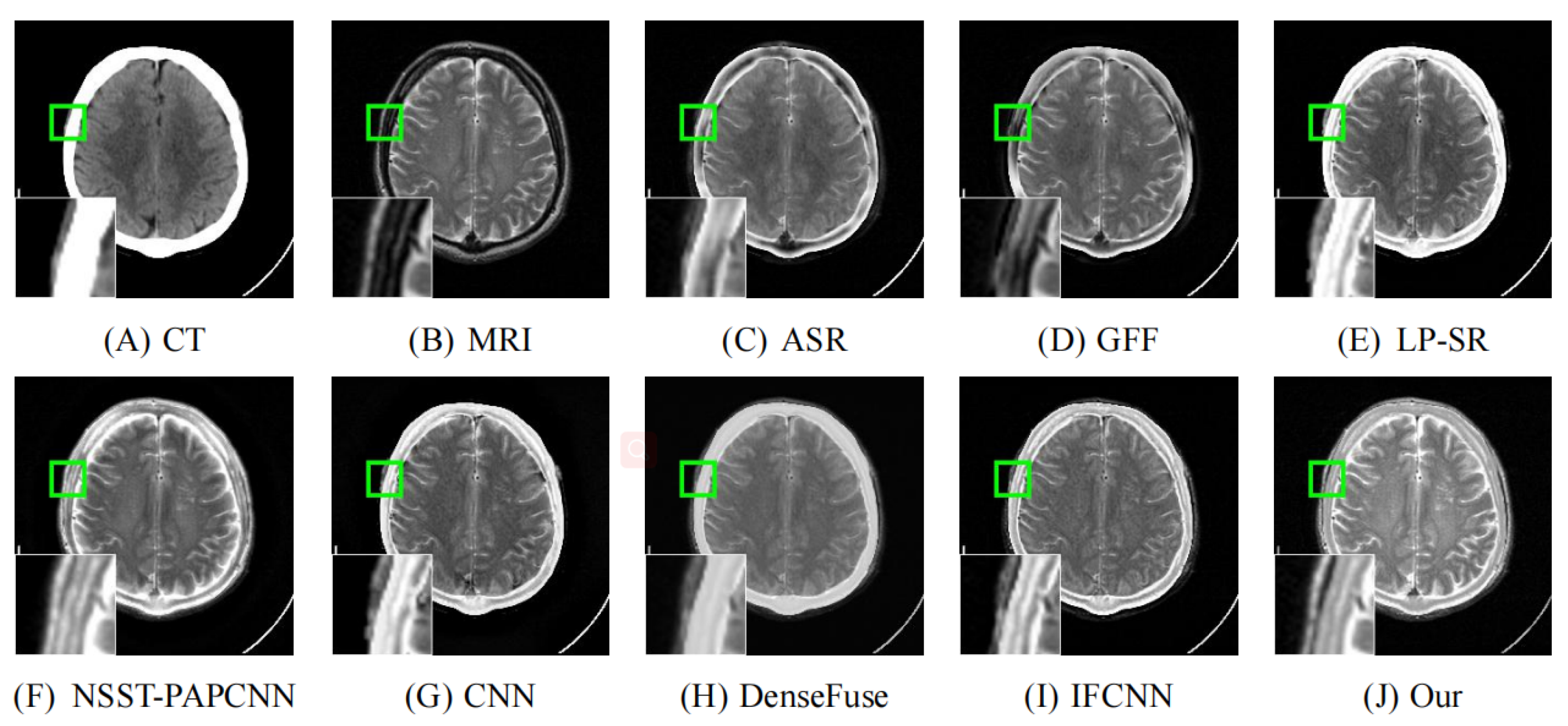 Entropy 24 00843 g009 550