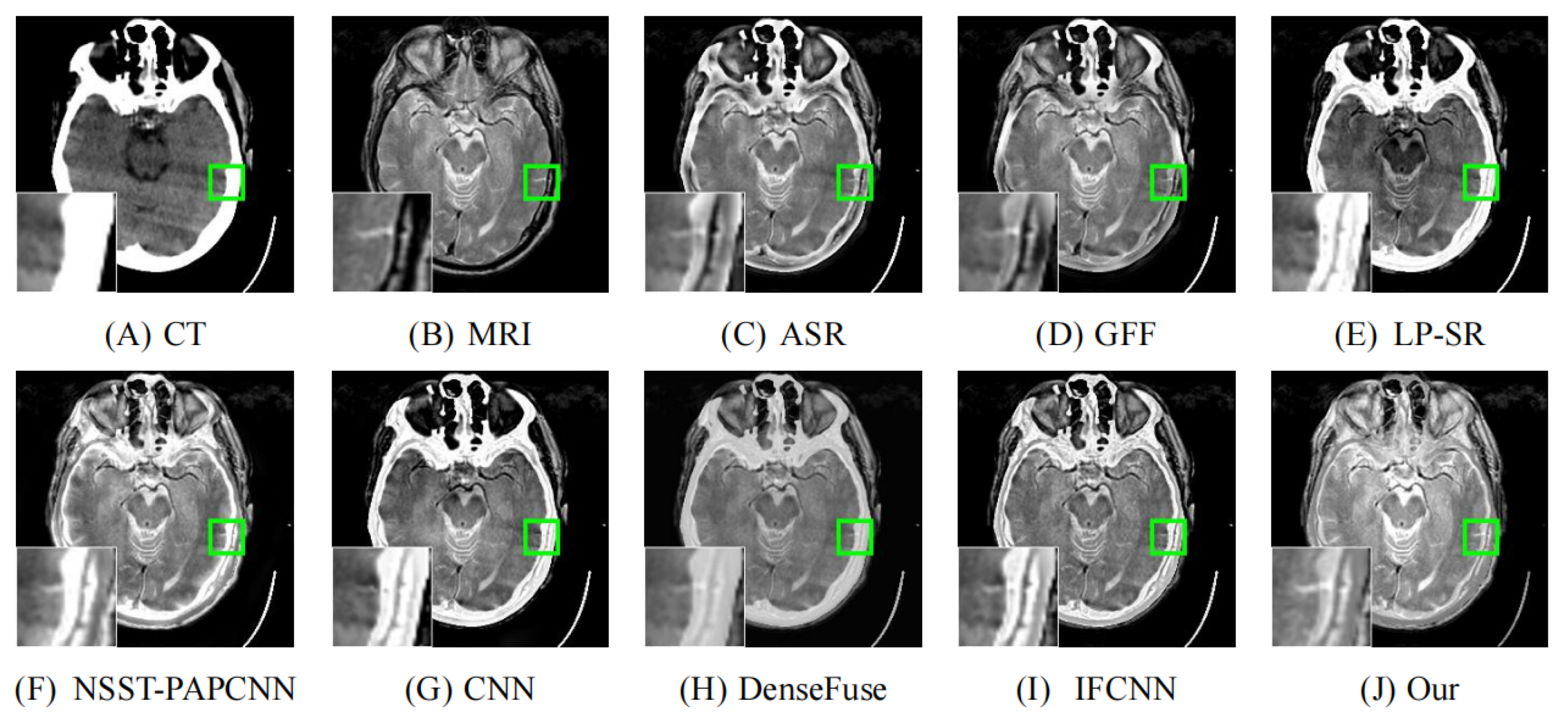 Entropy 24 00843 g010 550